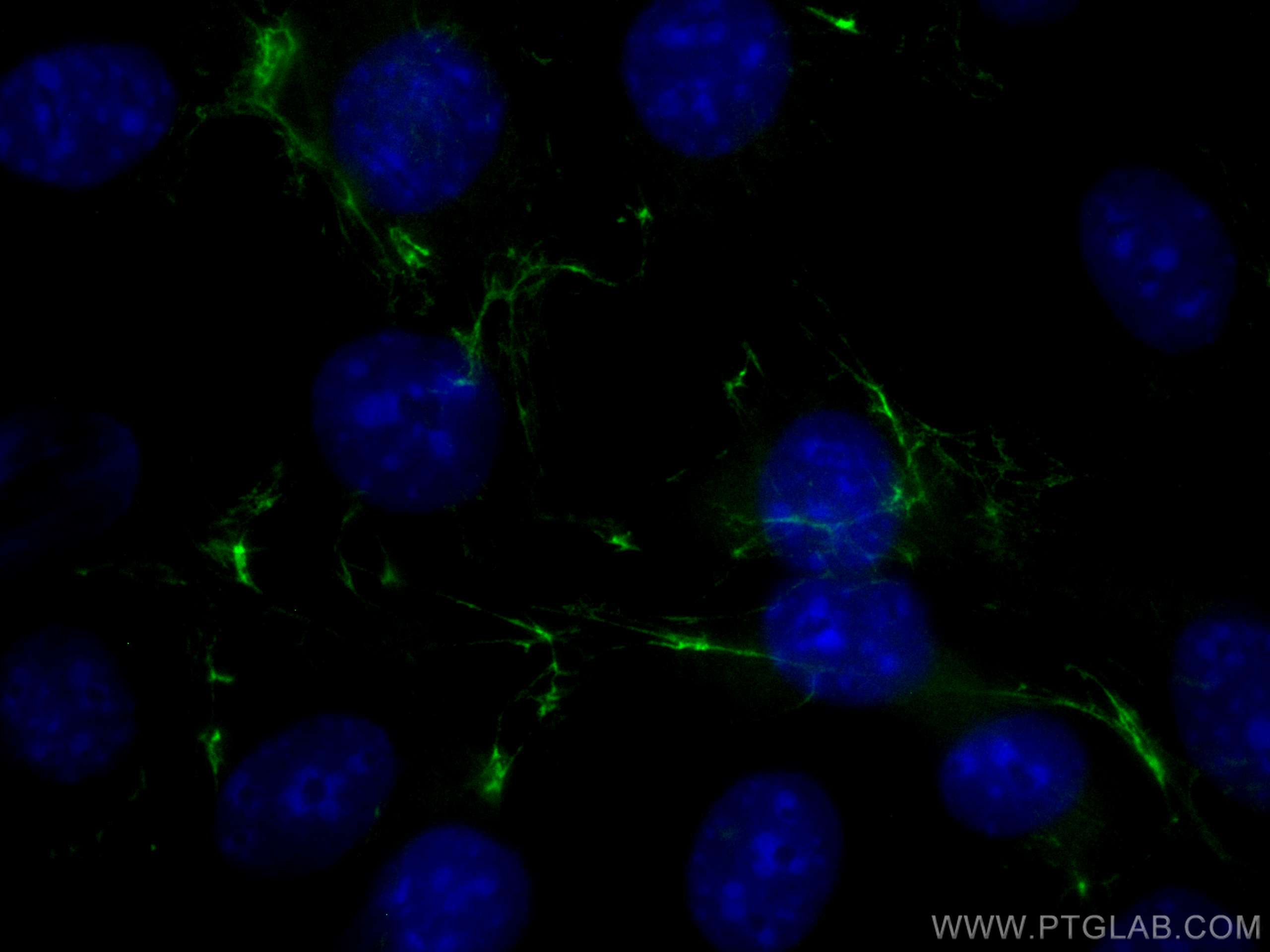 Fibronectin