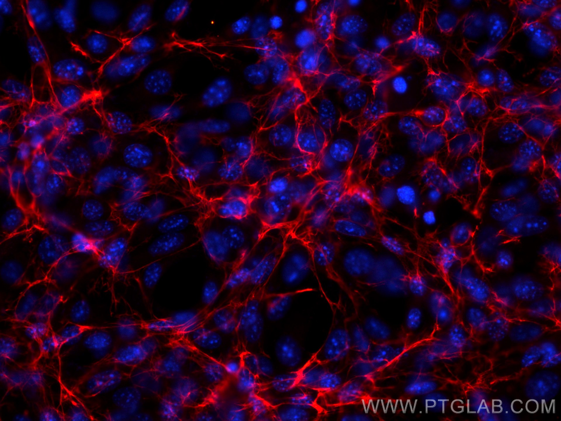 IF Staining of NIH/3T3 using CL594-15613