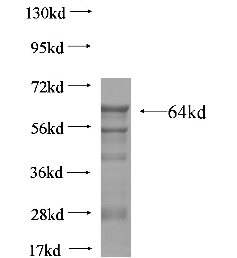 Fig4 fusion protein Ag6429 SDS-PAGE Fig4 fusion protein Ag6429 SDS-PAGE