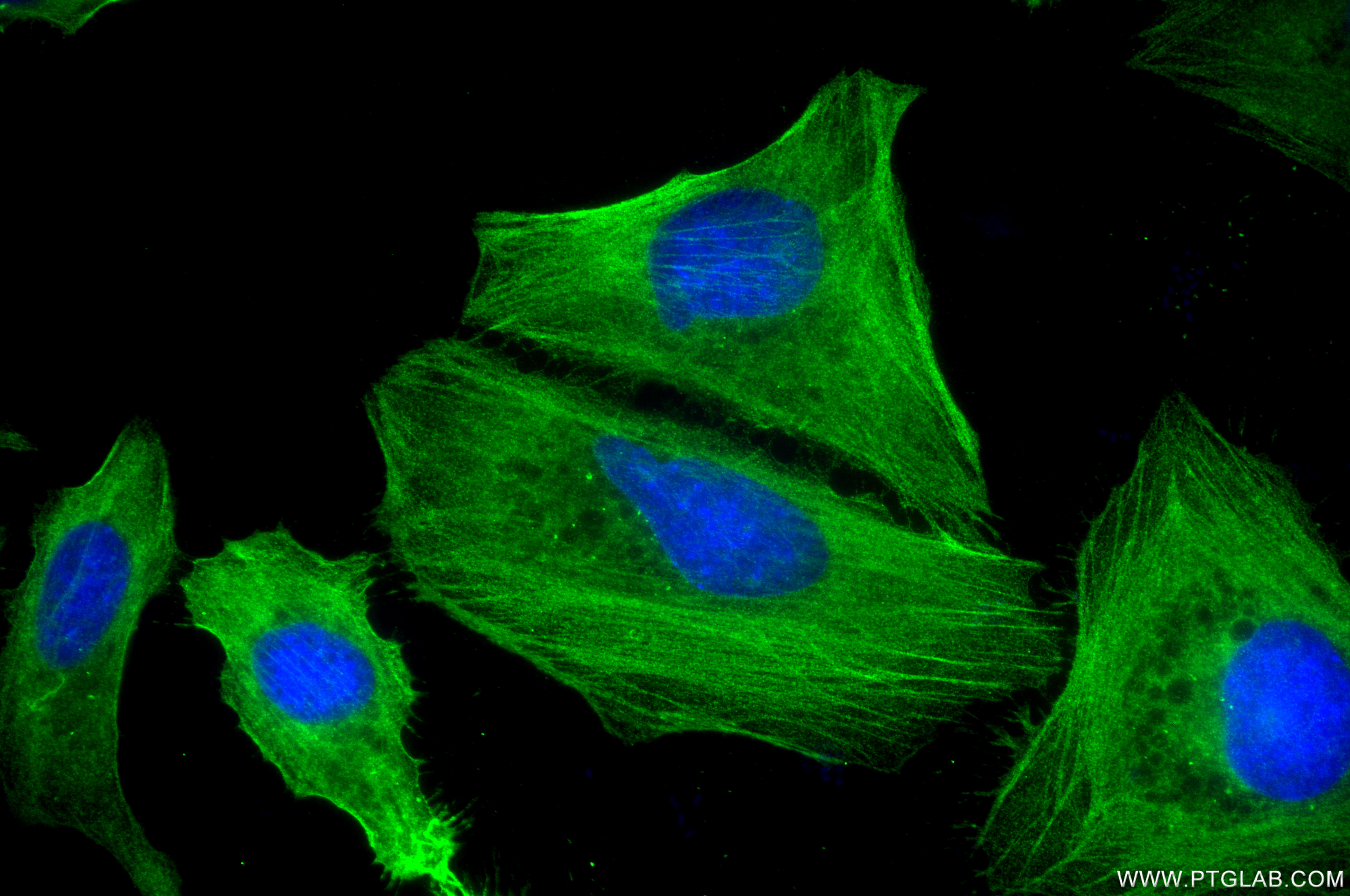 IF Staining of HeLa using 86959-3-RR (same clone as 86959-3-PBS) IF Staining of HeLa using 86959-3-RR (same clone as 86959-3-PBS)