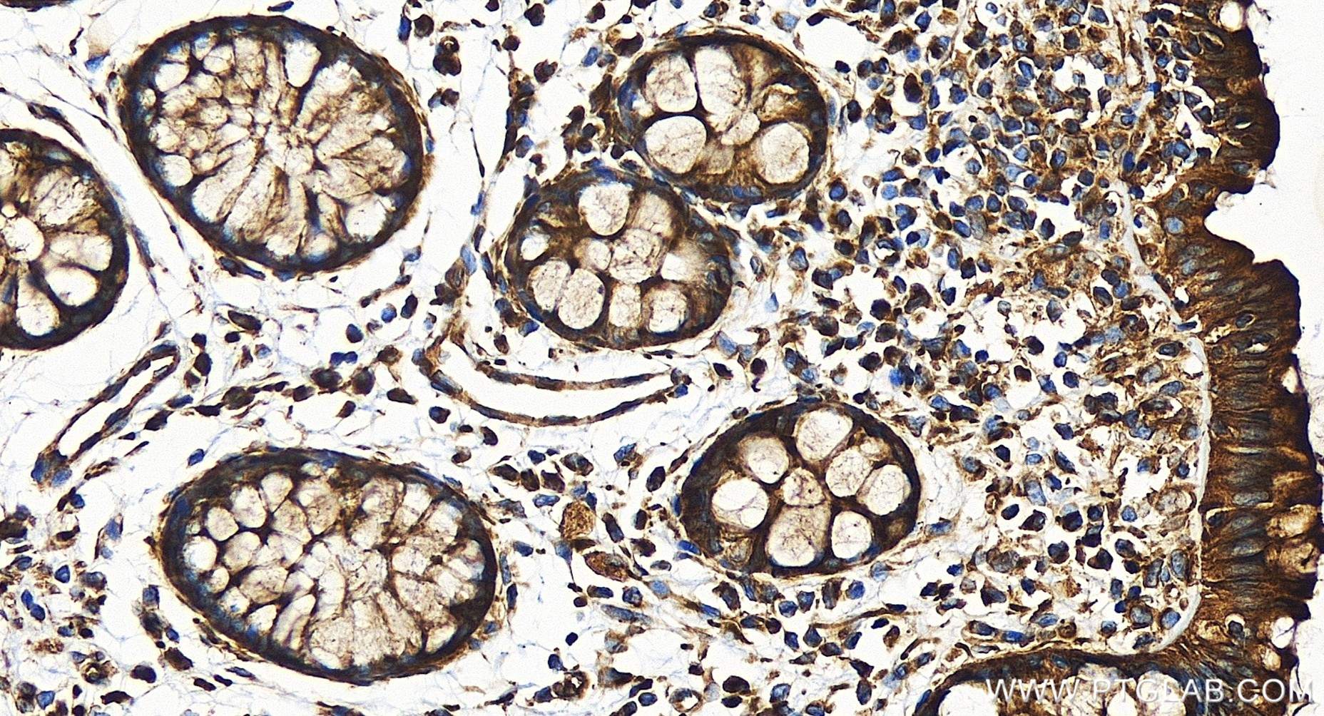 IHC staining of human colon using 85202-1-RR