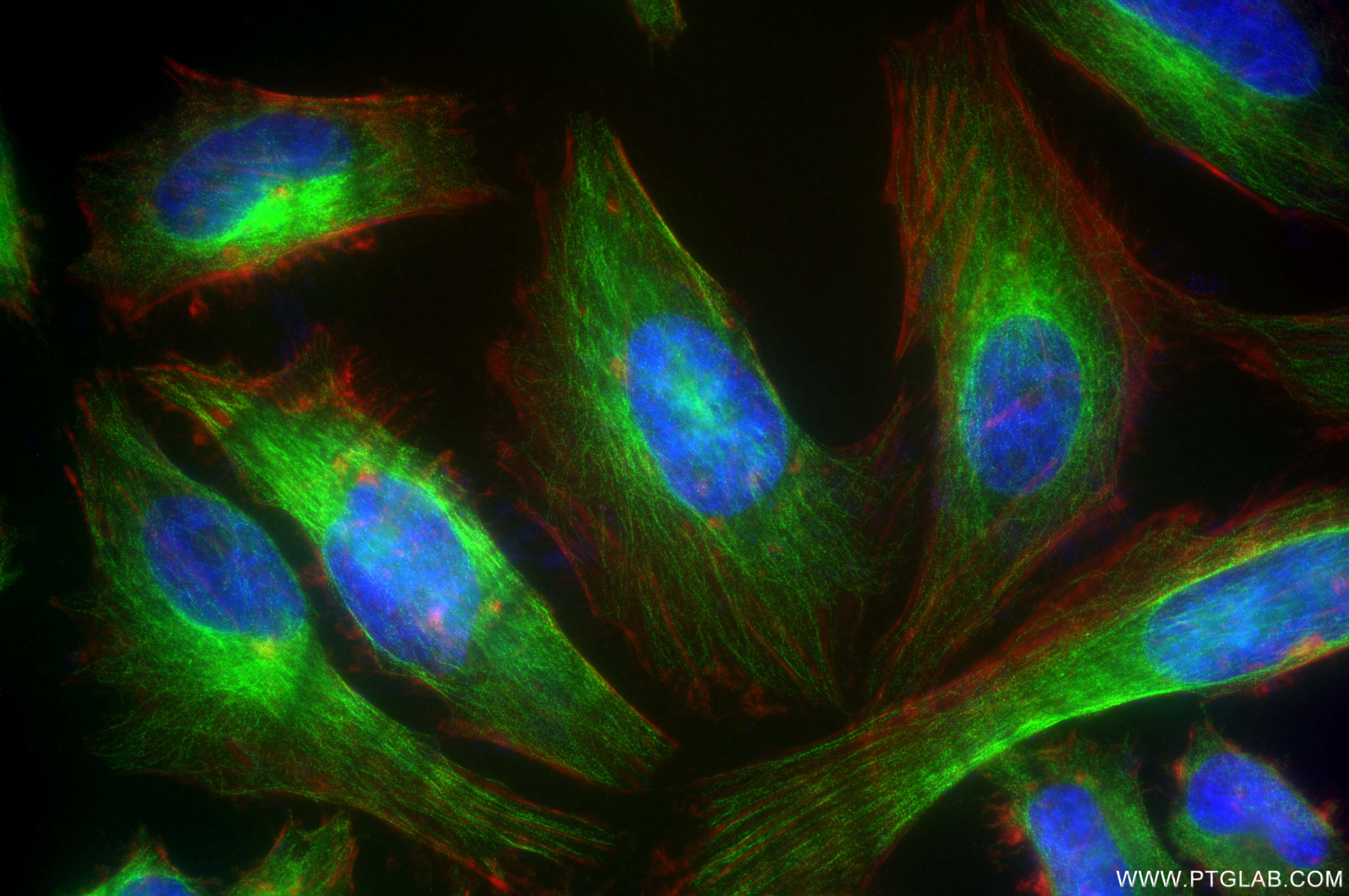 IF Staining of HeLa using 85202-1-RR (same clone as 85202-1-PBS)