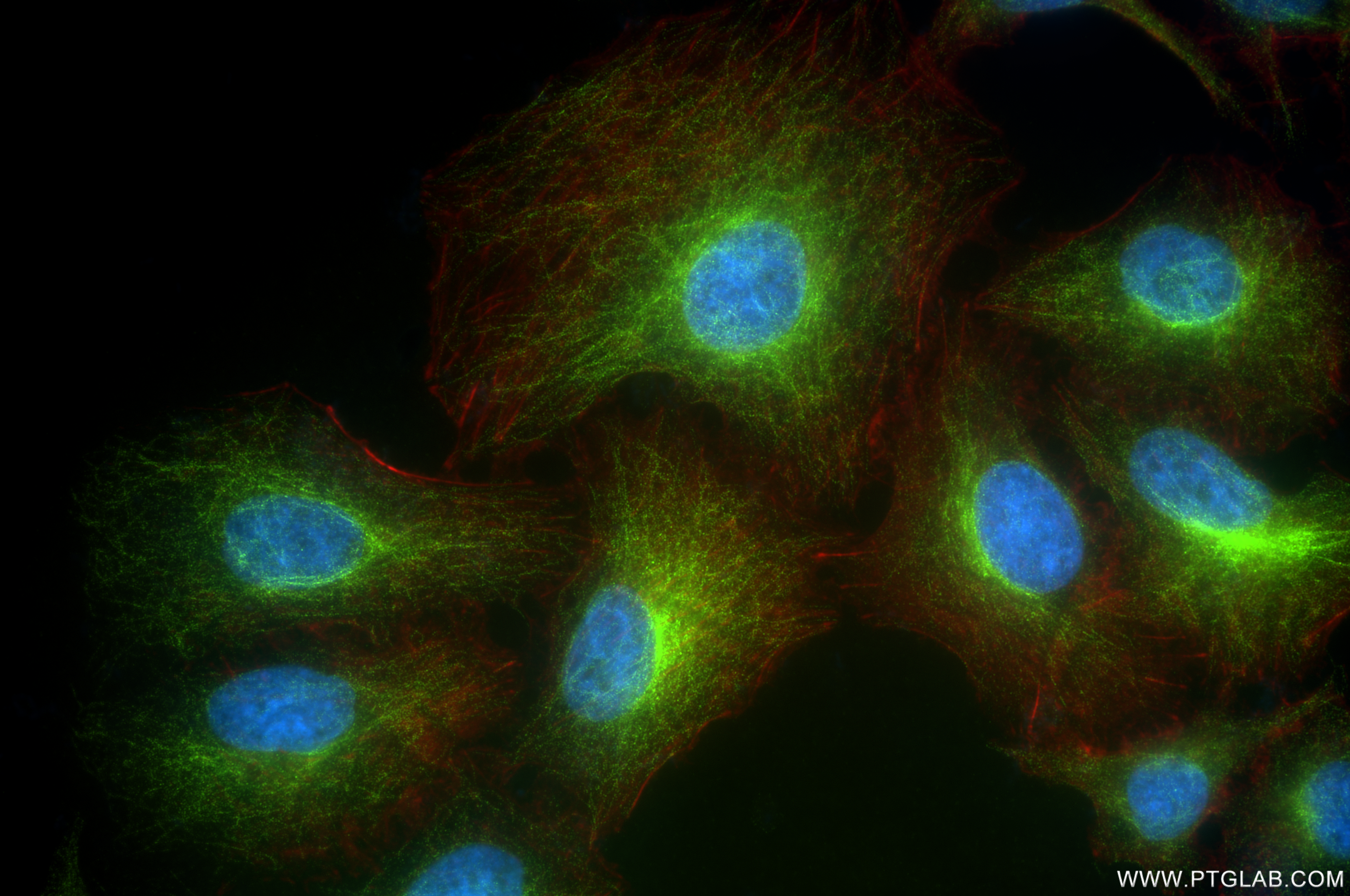 IF Staining of A549 using 85202-1-RR (same clone as 85202-1-PBS)