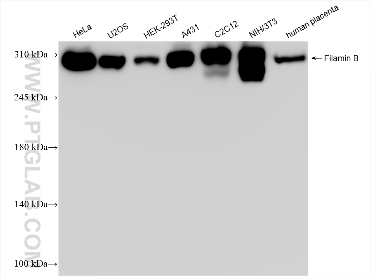 WB analysis using 85202-3-RR