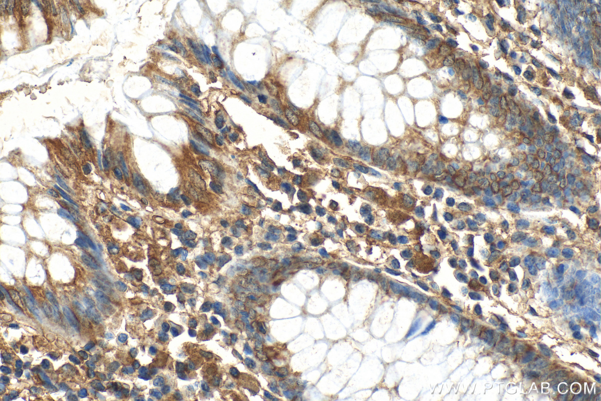 IHC staining of human colon using 27729-1-AP