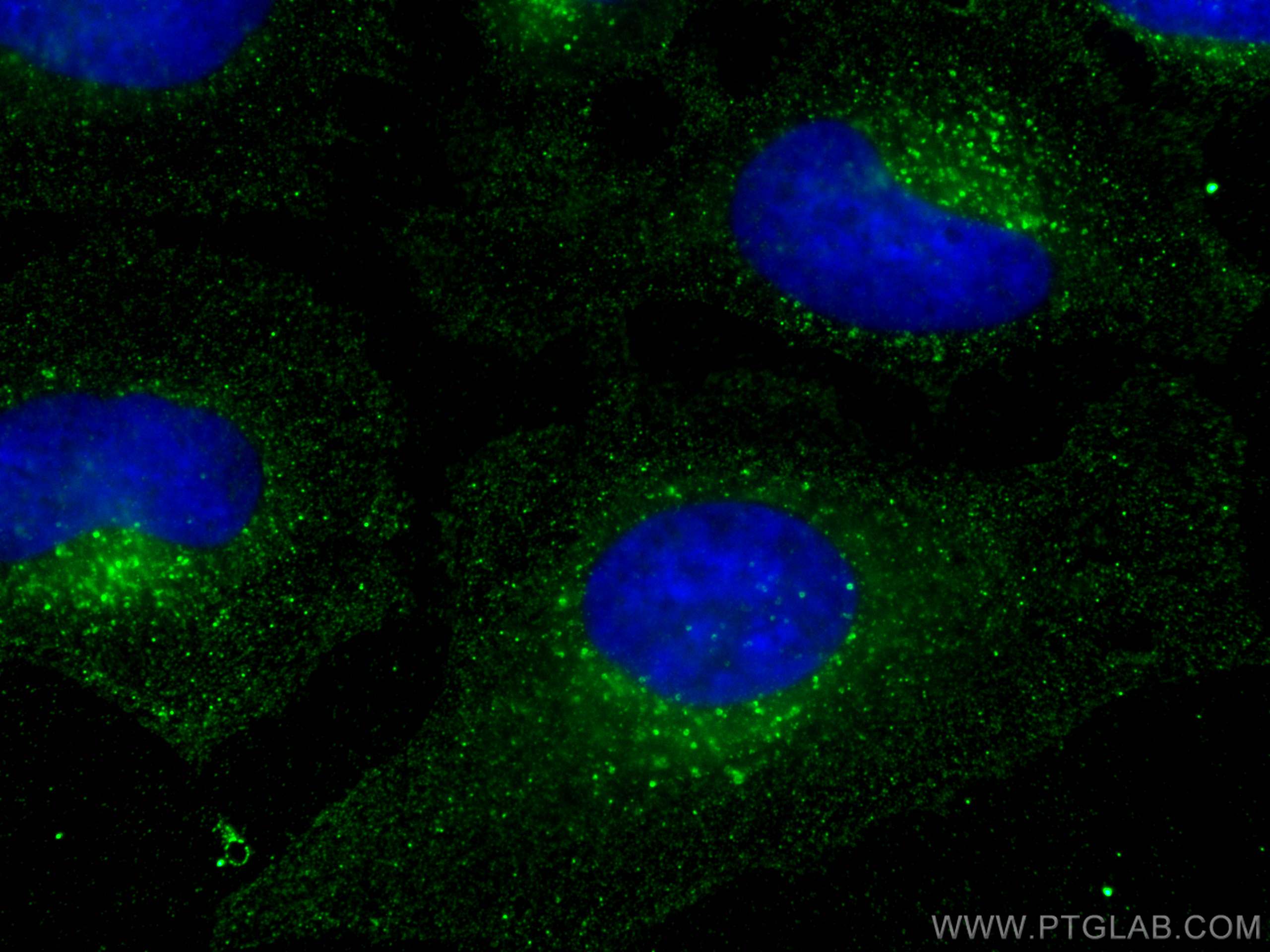 IF Staining of HeLa using 66881-1-Ig