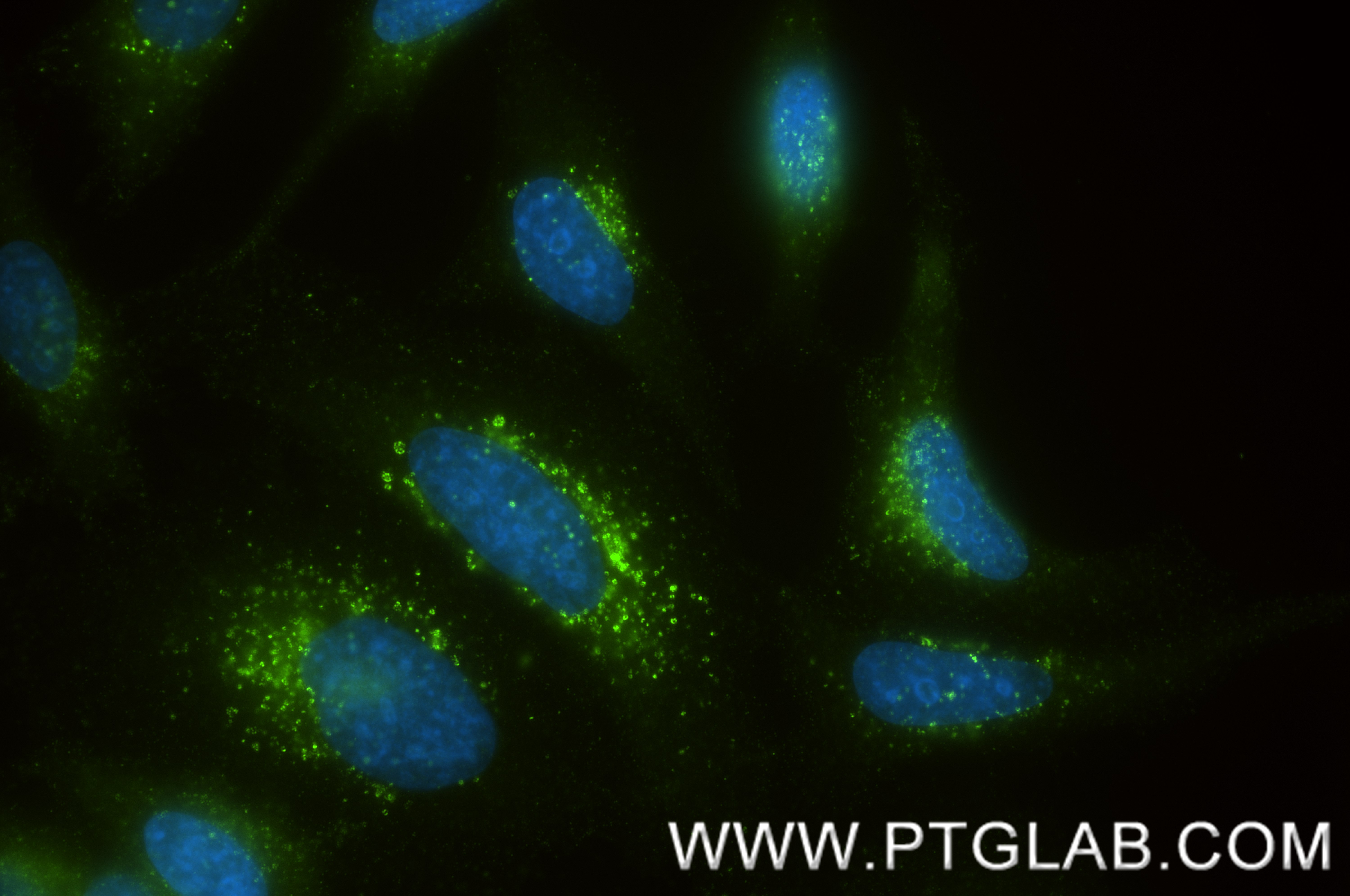 IF Staining of HeLa using 88149-1-RR IF Staining of HeLa using 88149-1-RR