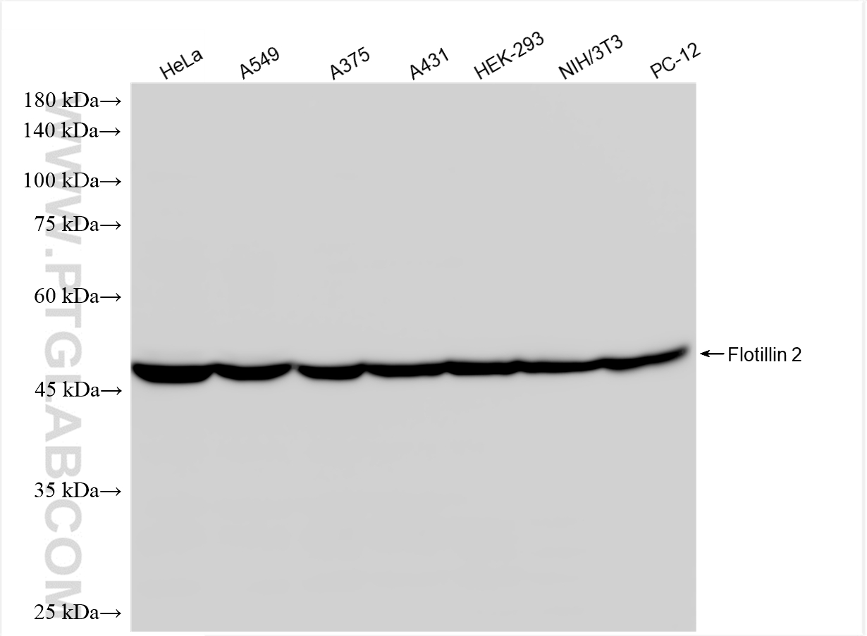 WB analysis using 88149-1-RR WB analysis using 88149-1-RR