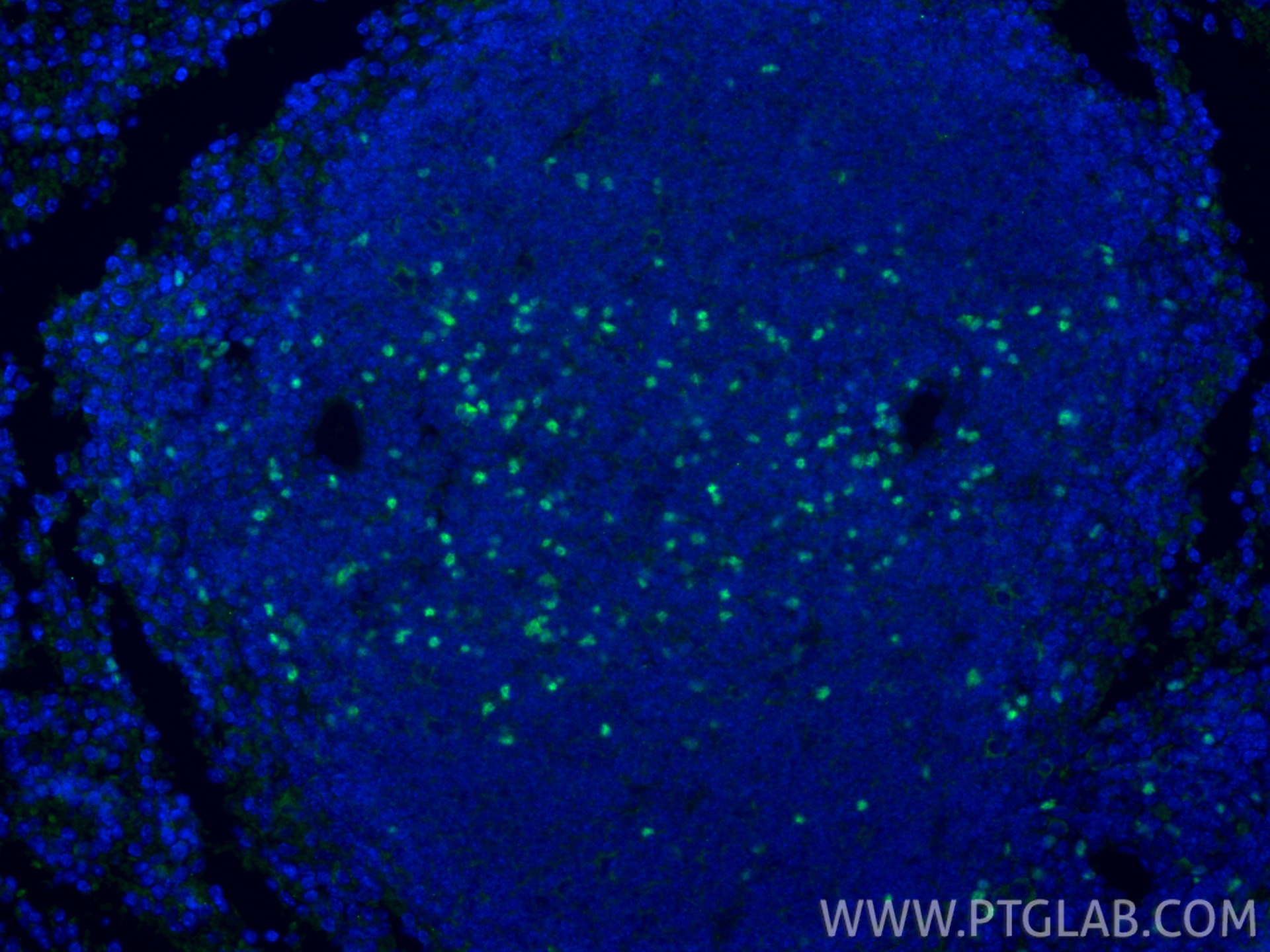 Immunofluorescent analysis of (4% PFA) fixed paraffin-embedded mouse spleen tissue using Foxp3 antibody (85128-6-RR, Clone: 242853G11 ) at dilution of 1:1000 and CoraLite®488-Conjugated Goat Anti-Rabbit IgG(H+L) (<a class='green' href='/productredirect?CatalogNo=SA00013-2' target='_blank'>SA00013-2</a>). Heat mediated antigen retrieval with Tris-EDTA buffer (pH 9.0). IF Staining of mouse spleen using 85128-6-RR