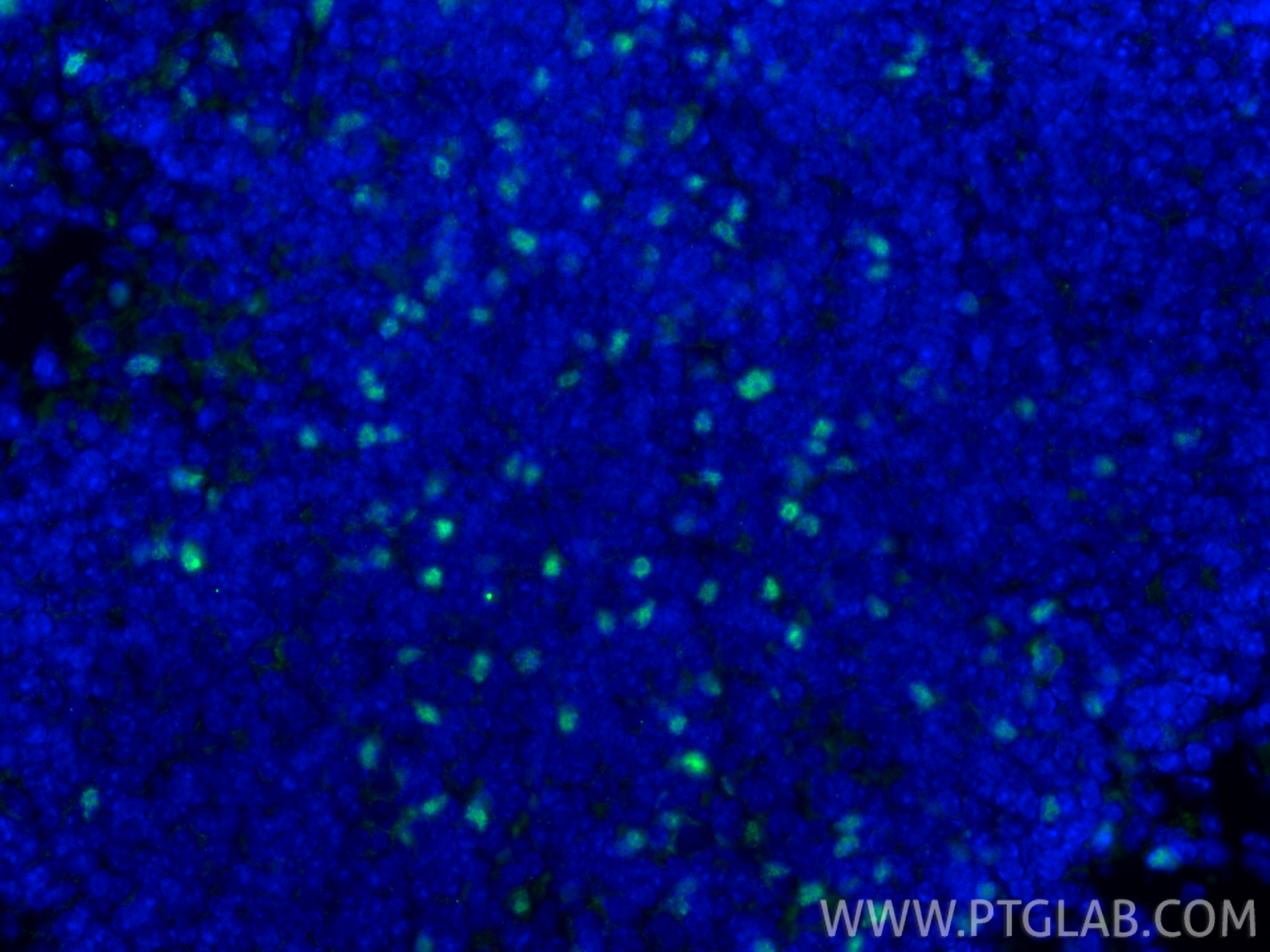 Immunofluorescent analysis of (4% PFA) fixed paraffin-embedded mouse spleen tissue using Foxp3 antibody (85128-6-RR, Clone: 242853G11 ) at dilution of 1:1000 and CoraLite®488-Conjugated Goat Anti-Rabbit IgG(H+L) (<a class='green' href='/productredirect?CatalogNo=SA00013-2' target='_blank'>SA00013-2</a>). Heat mediated antigen retrieval with Tris-EDTA buffer (pH 9.0). IF Staining of mouse spleen using 85128-6-RR