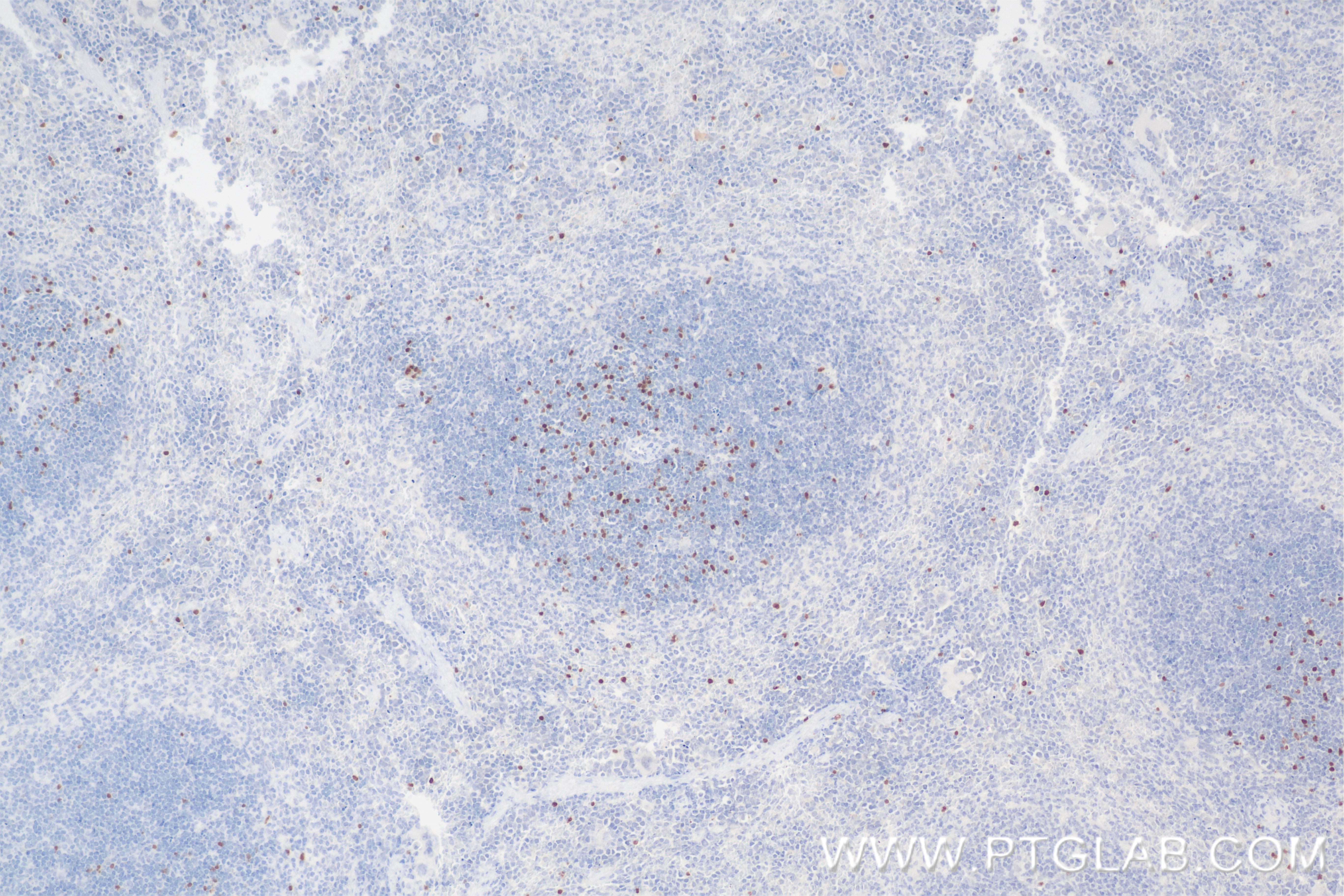 IHC staining of mouse spleen using 85128-6-RR