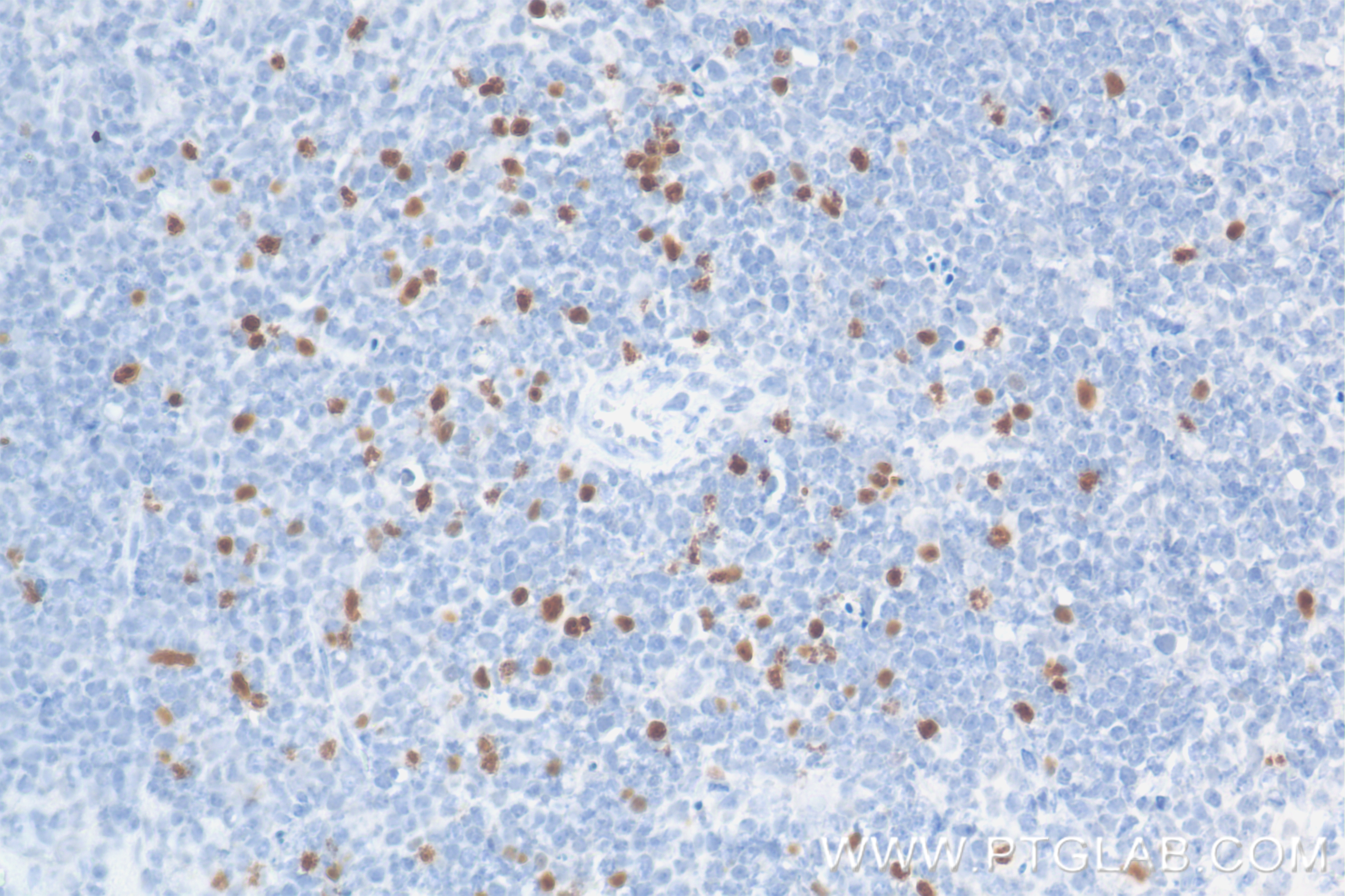 IHC staining of mouse spleen using 85128-6-RR