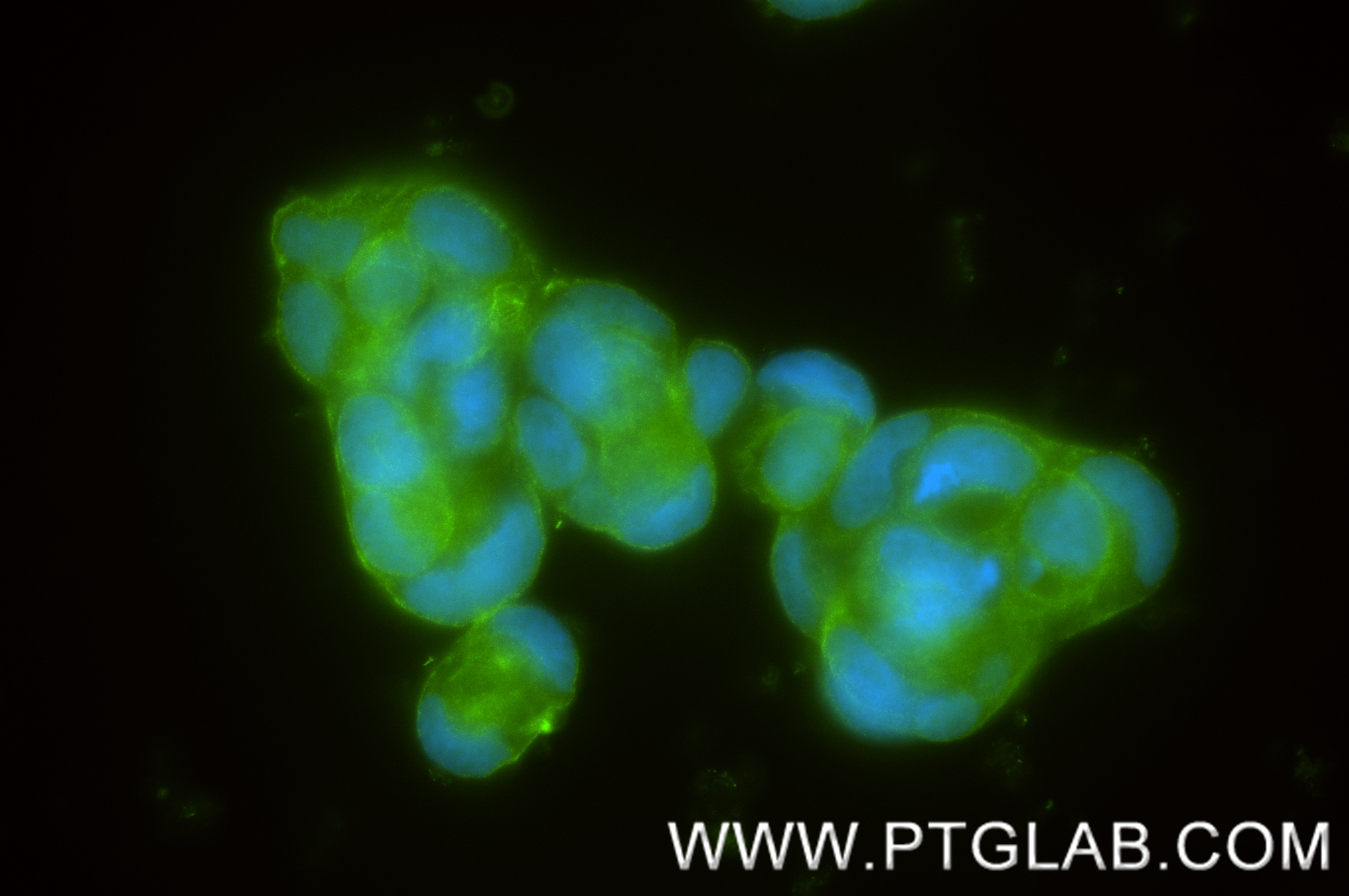 IF Staining of Caco-2 using 85829-2-RR