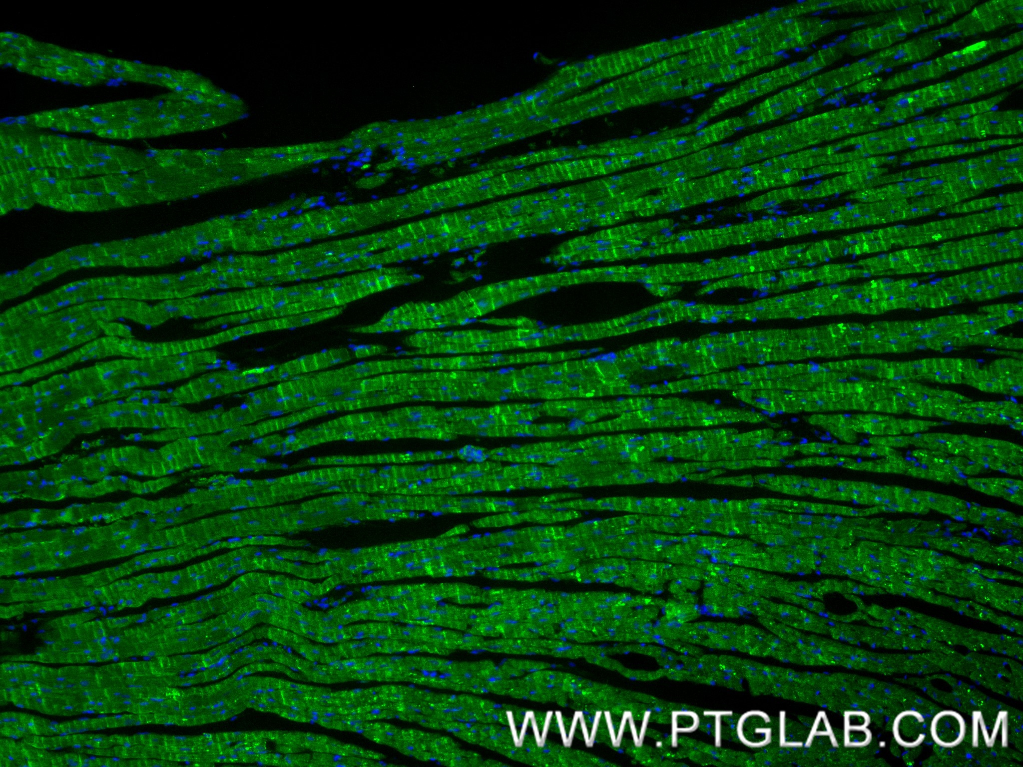 IF Staining of mouse heart using 87975-1-RR (same clone as 87975-1-PBS) IF Staining of mouse heart using 87975-1-RR (same clone as 87975-1-PBS)