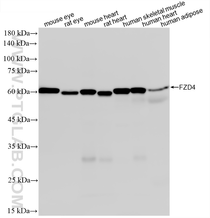 WB analysis using 87975-1-RR