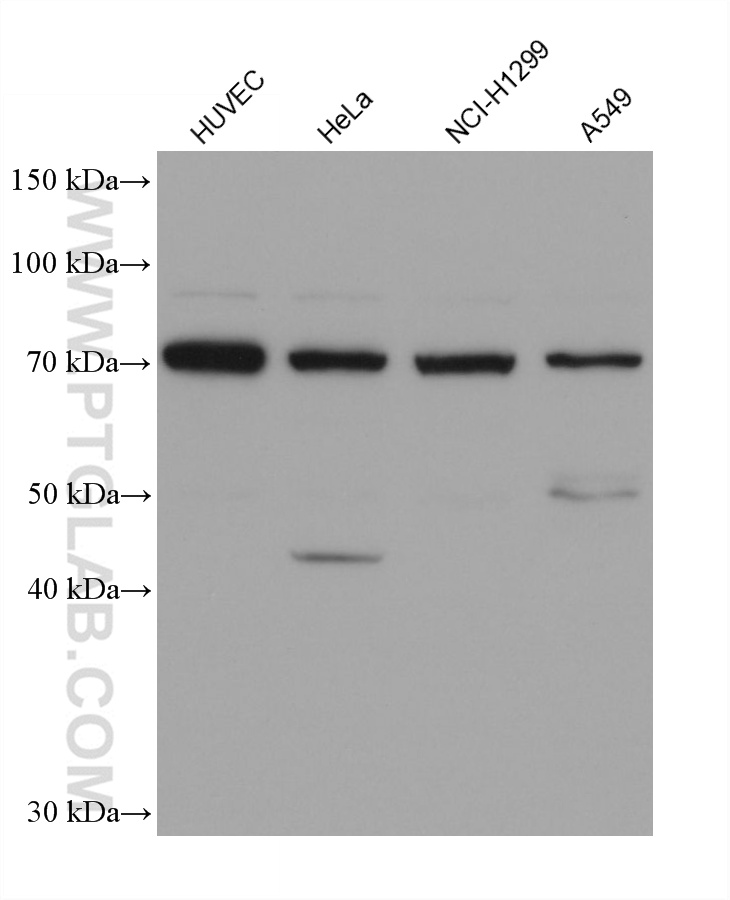 WB analysis using 67023-1-Ig (same clone as 67023-1-PBS)