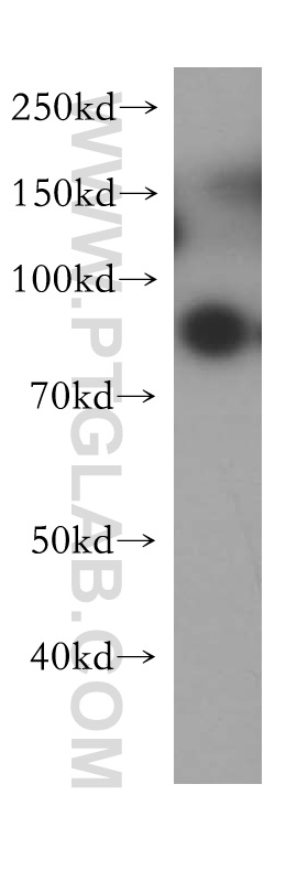 WB analysis of human placenta using 18310-1-AP