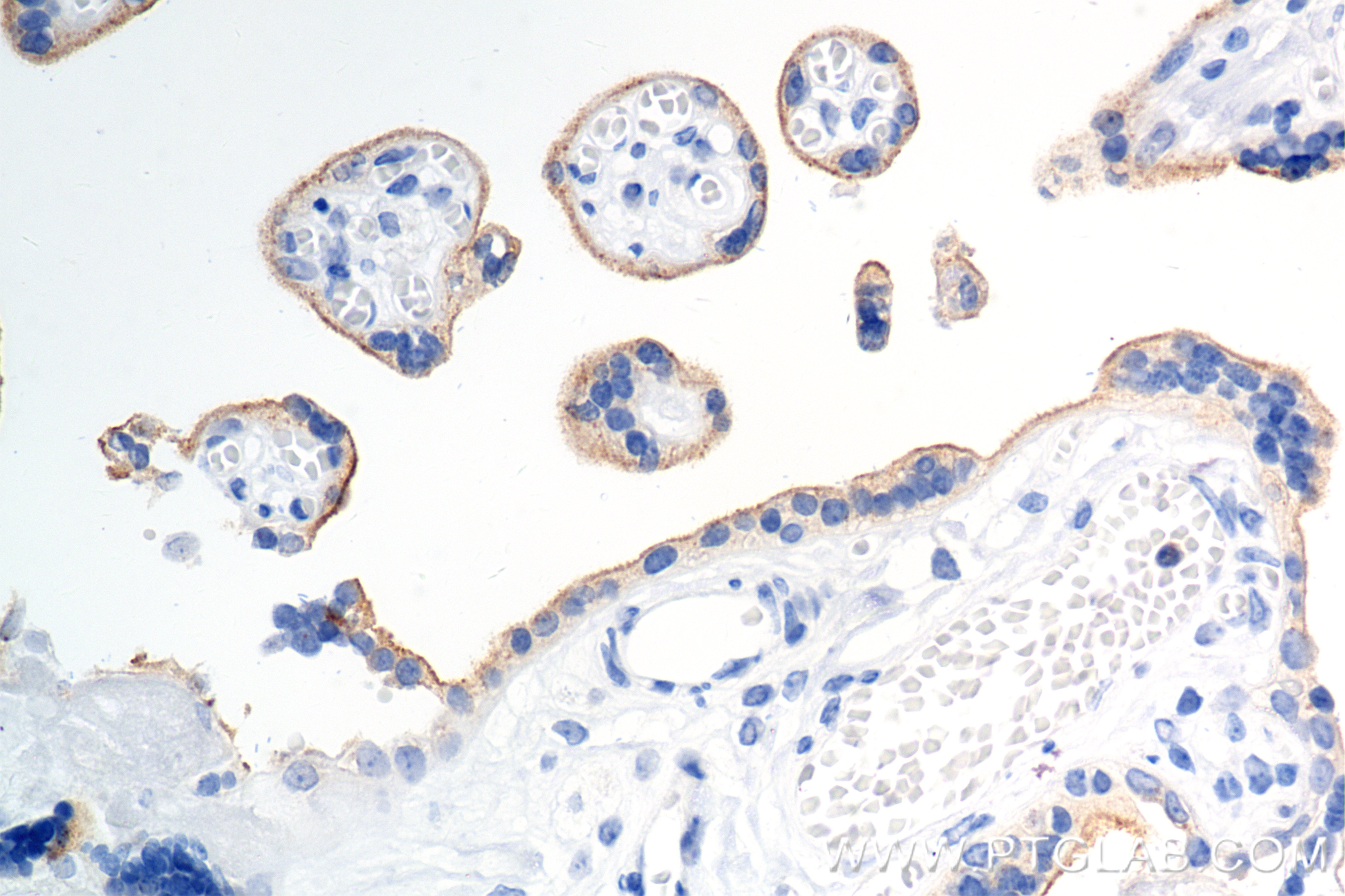 IHC staining of human placenta using 84827-2-RR (same clone as 84827-2-PBS)