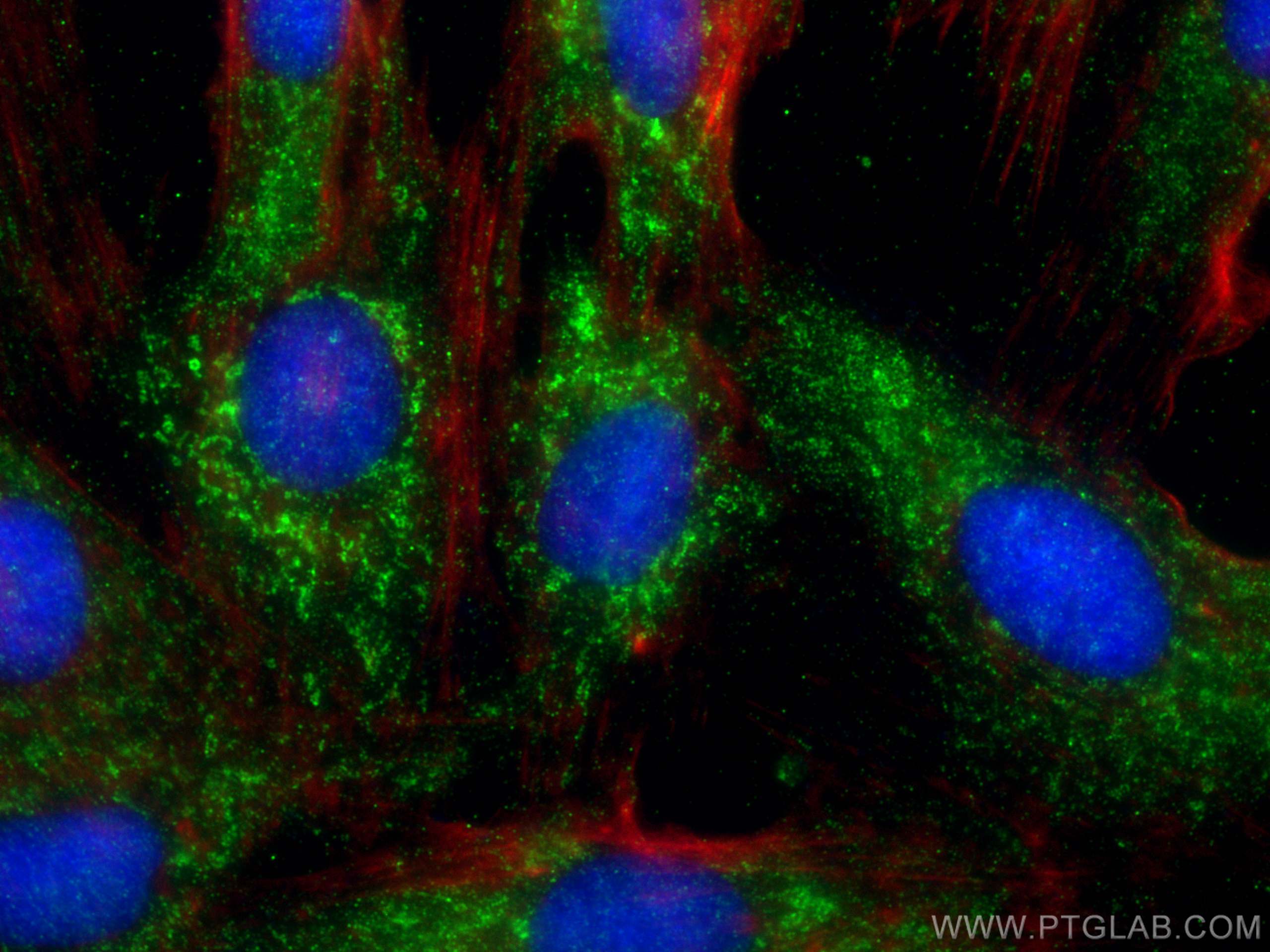 IF Staining of H9C2 using 12091-1-AP