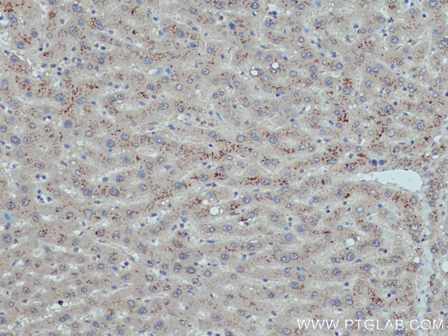 IHC staining of human liver using 12091-1-AP