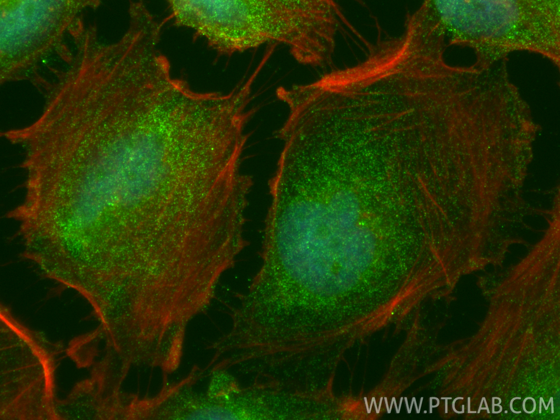 IF Staining of U-251 using 34058-1-AP IF Staining of U-251 using 34058-1-AP