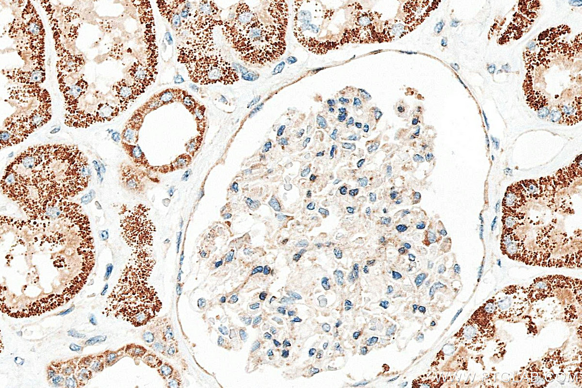 IHC staining of human kidney using 34058-1-AP