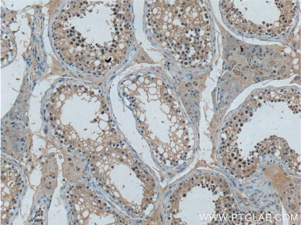 IHC staining of human testis using 66486-1-Ig