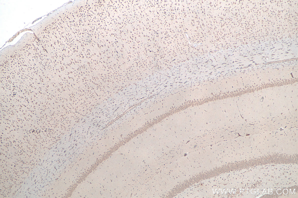 IHC staining of rat brain using 66486-1-Ig IHC staining of rat brain using 66486-1-Ig