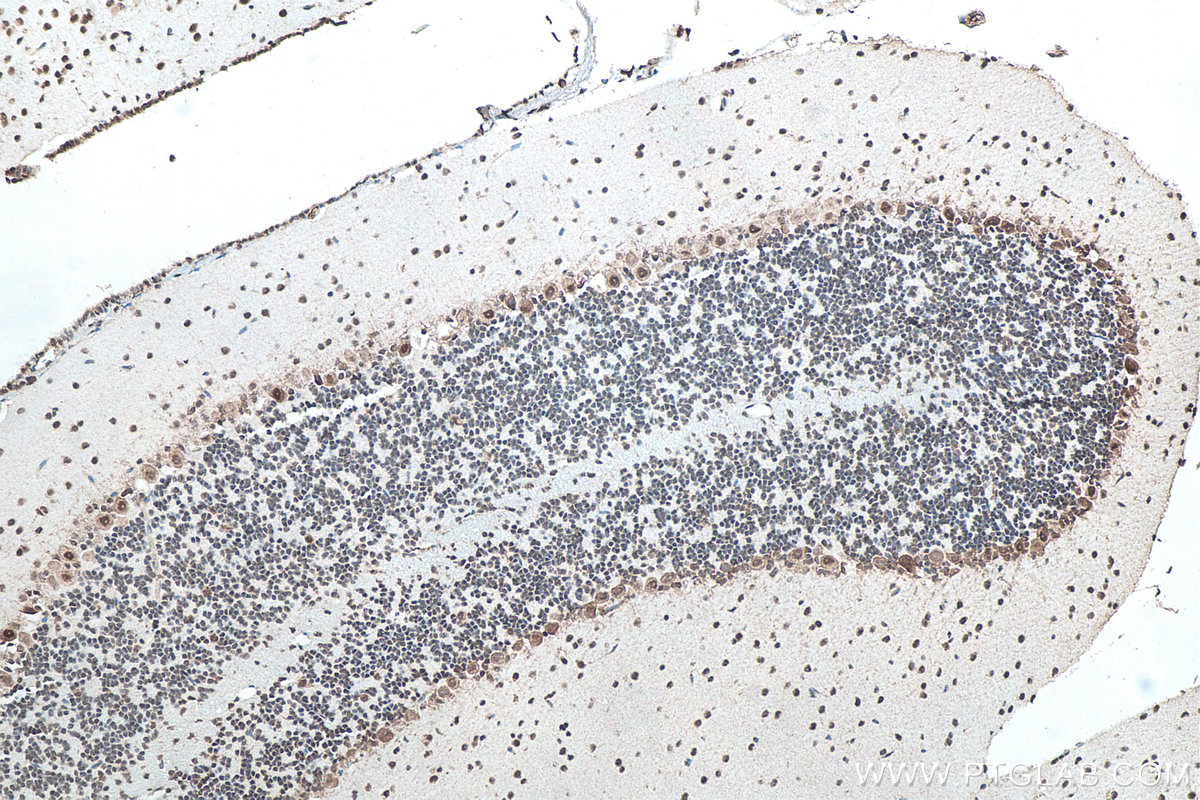 IHC staining of mouse cerebellum using 66486-1-Ig IHC staining of mouse cerebellum using 66486-1-Ig