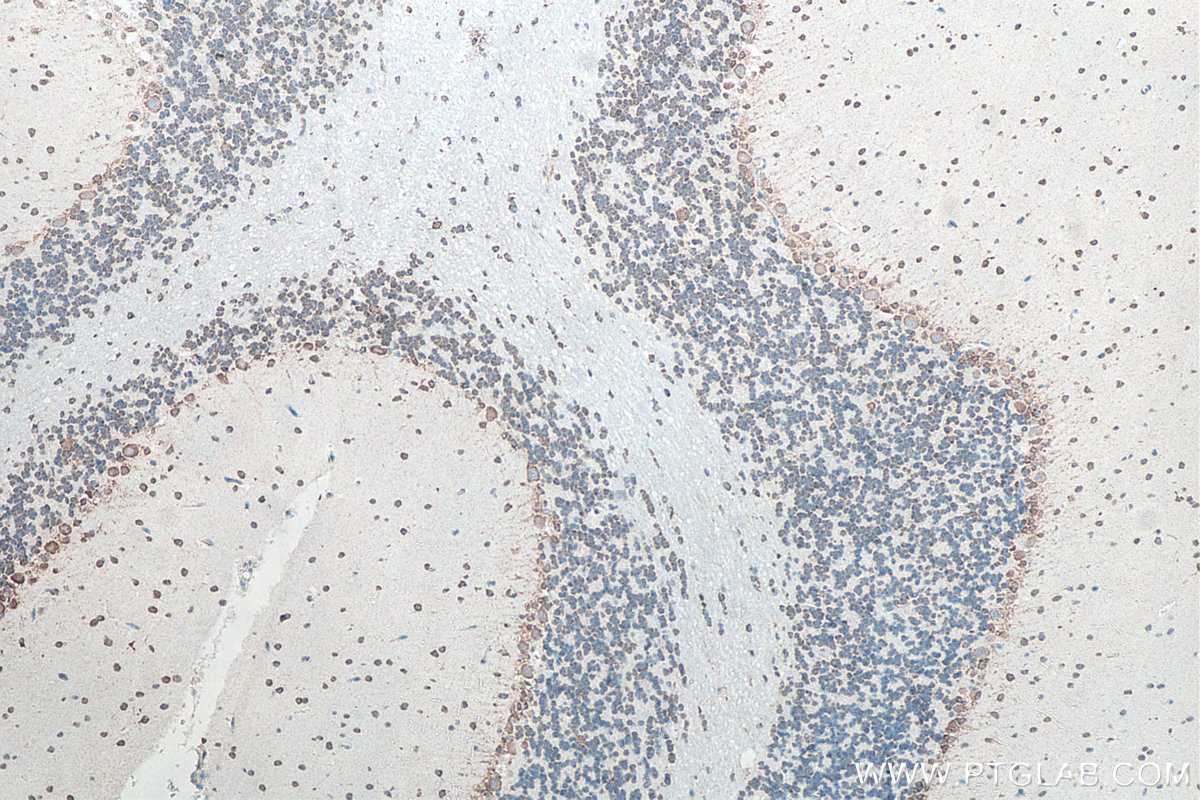 IHC staining of rat cerebellum using 66486-1-Ig IHC staining of rat cerebellum using 66486-1-Ig