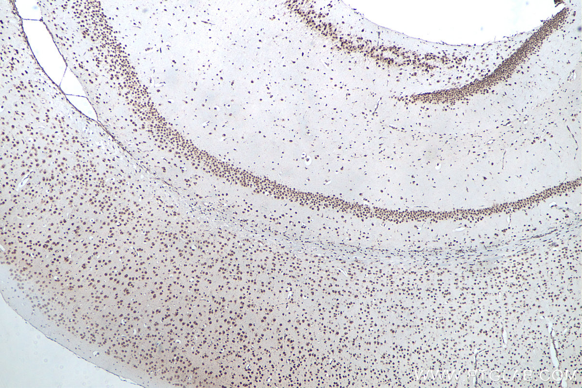IHC staining of mouse brain using 66486-1-Ig IHC staining of mouse brain using 66486-1-Ig