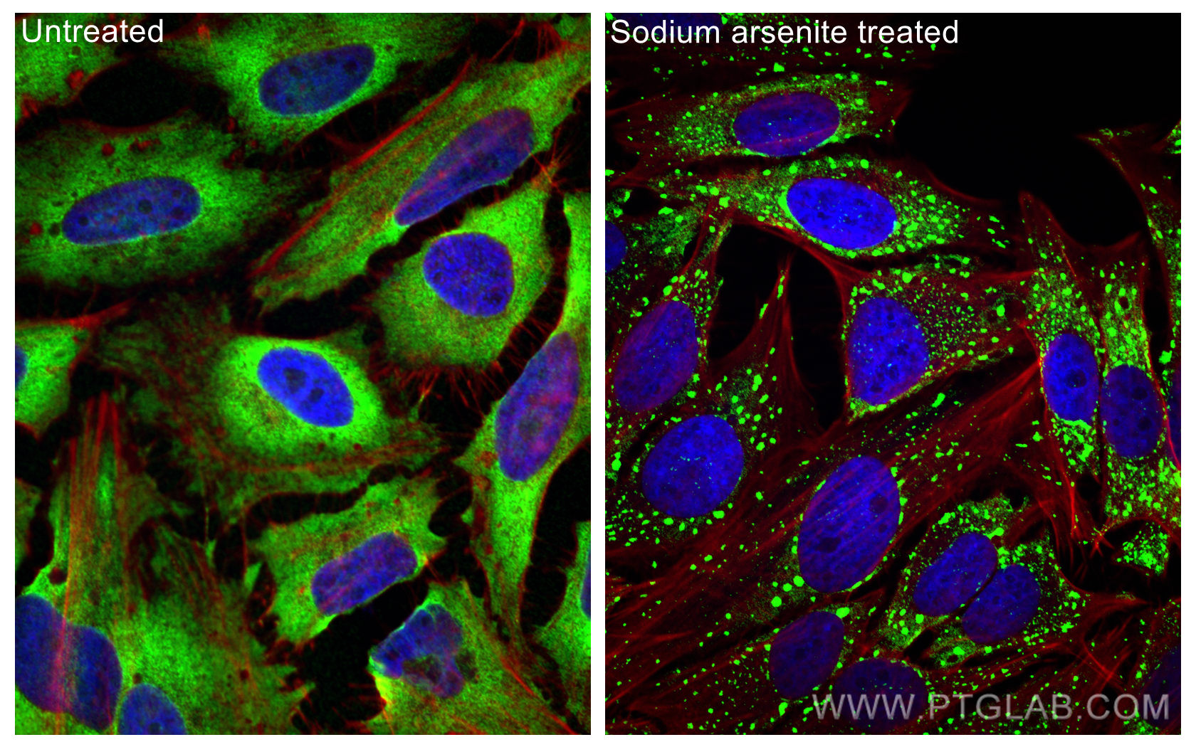 IF Staining of HeLa using 13057-2-AP