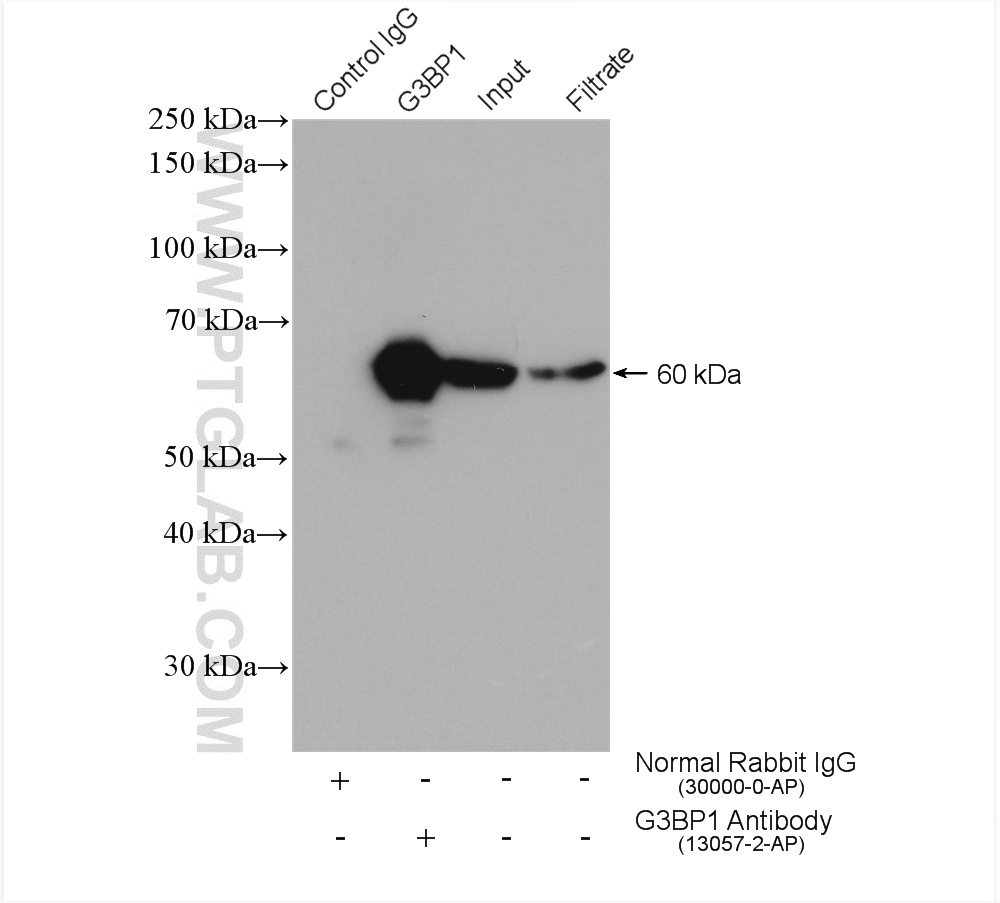 IP experiment of HEK-293 using 13057-2-AP