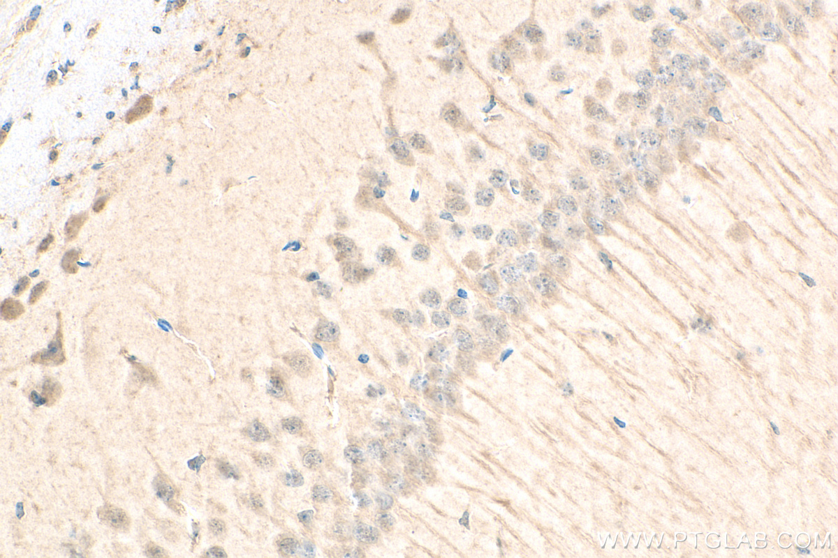 IHC staining of mouse brain using 80777-1-RR