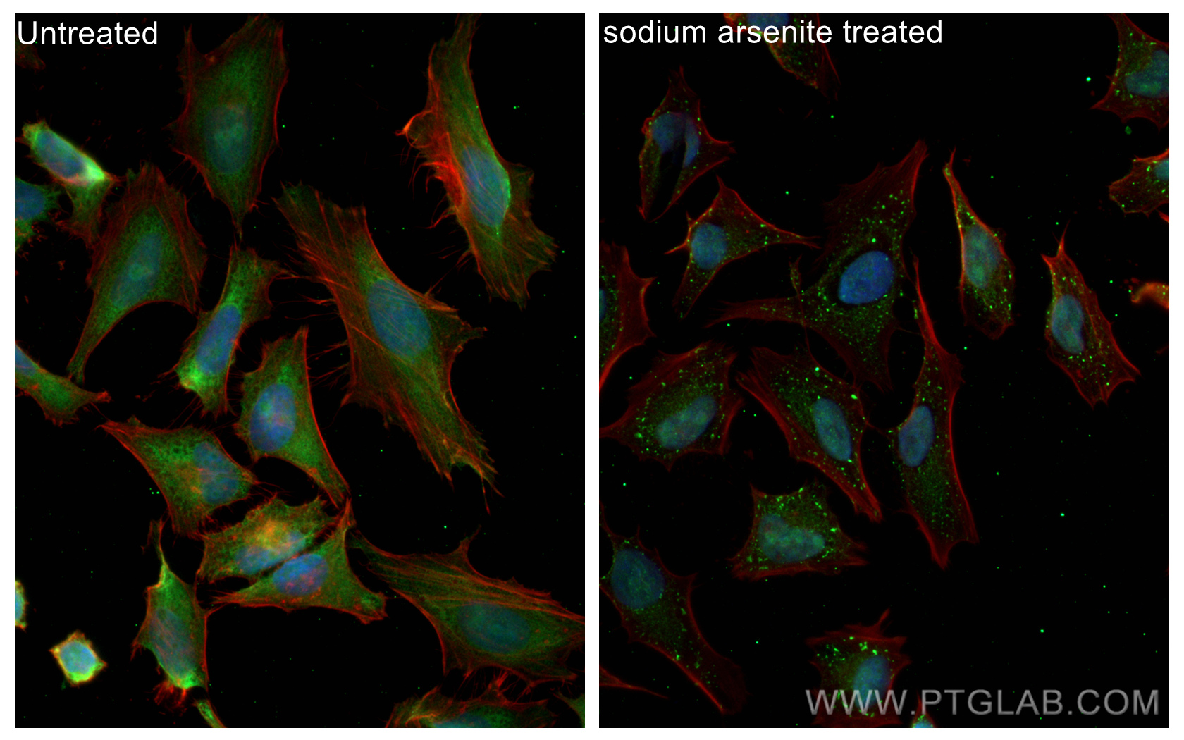 IF Staining of HeLa using CL488-80777