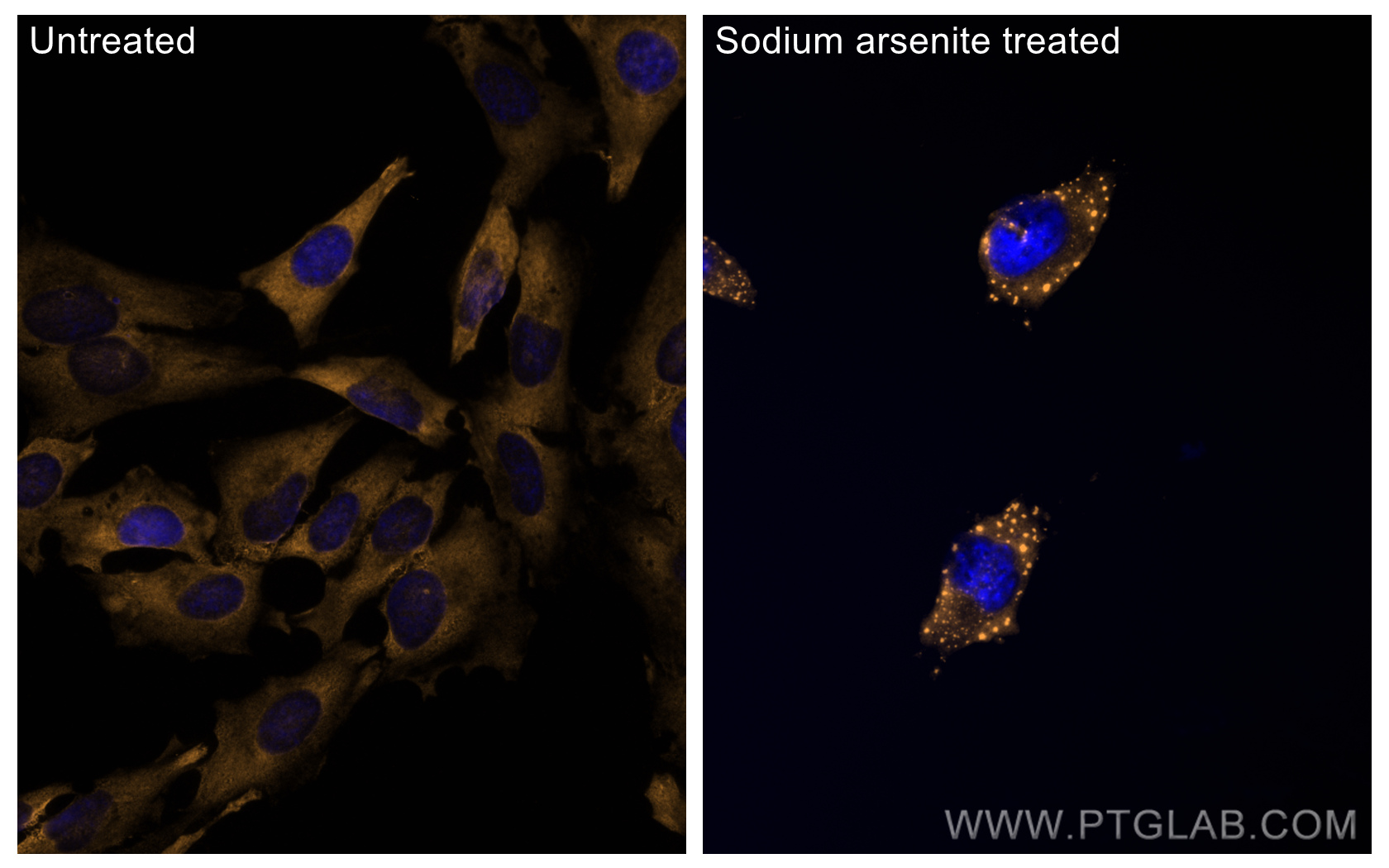 IF Staining of HeLa using CL555-13057