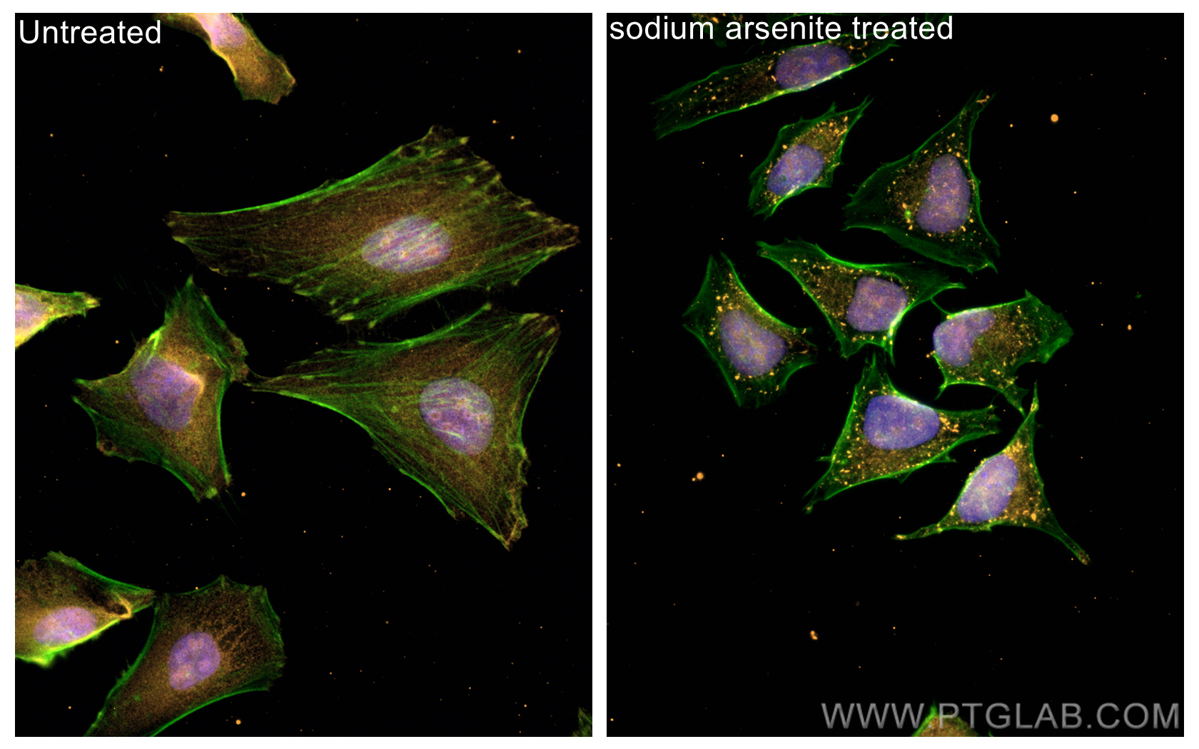 IF Staining of HeLa using CL555-80777