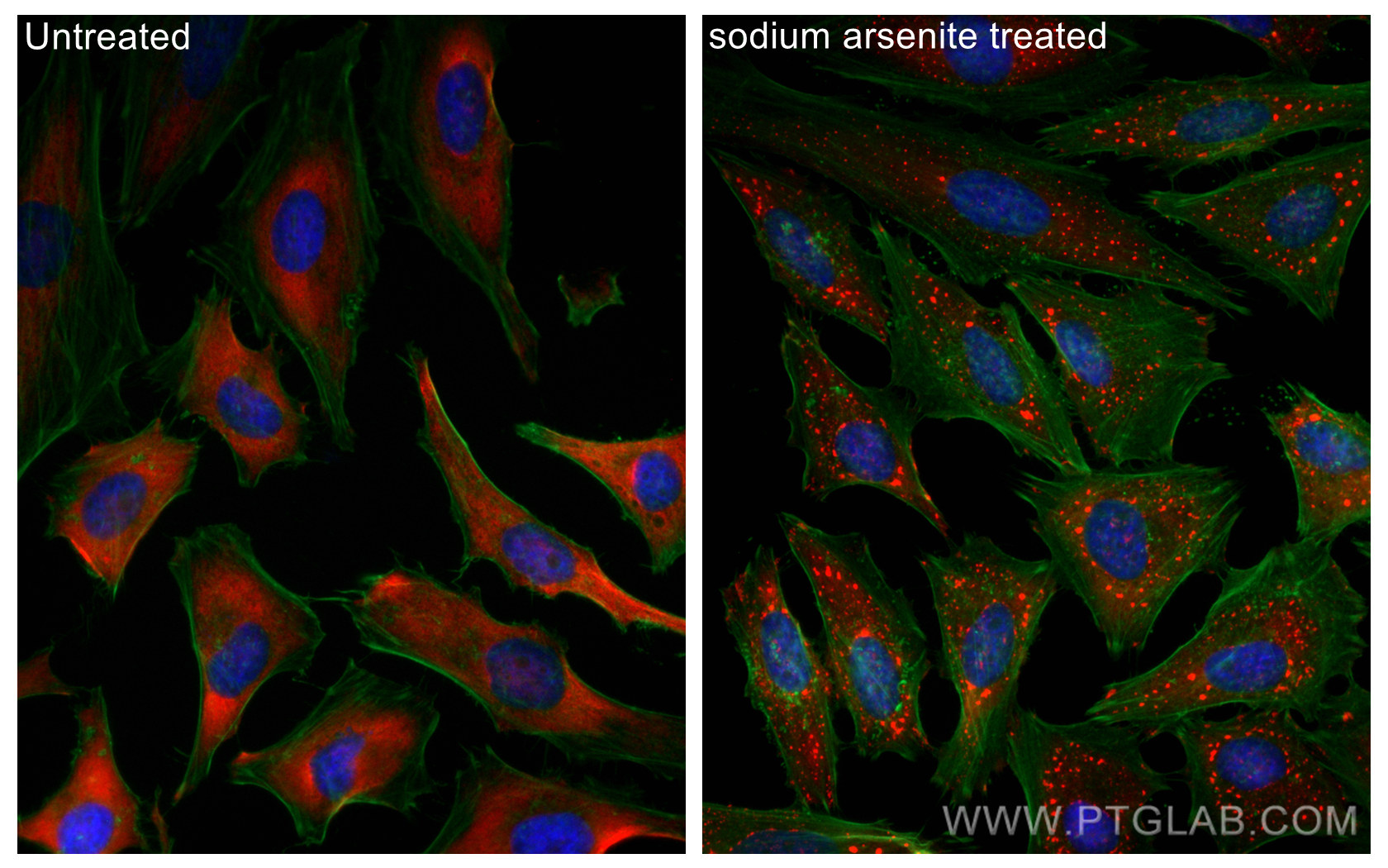 IF Staining of HeLa using CL594-13057