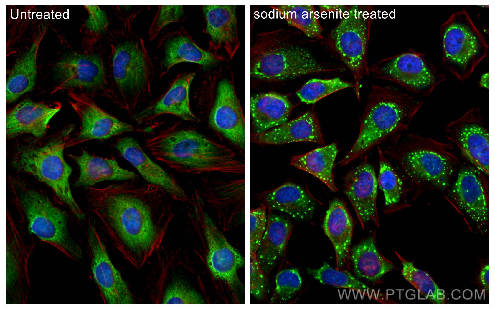 IF Staining of HeLa using 82080-6-RR (same clone as 82080-6-PBS)