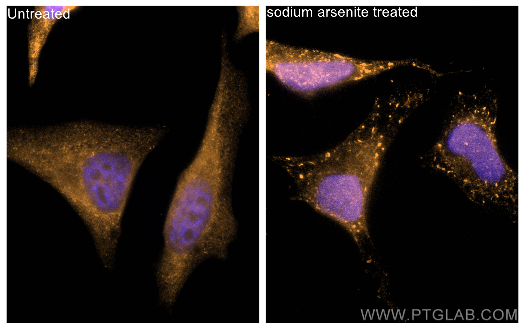 IF Staining of HeLa using CL555-16276