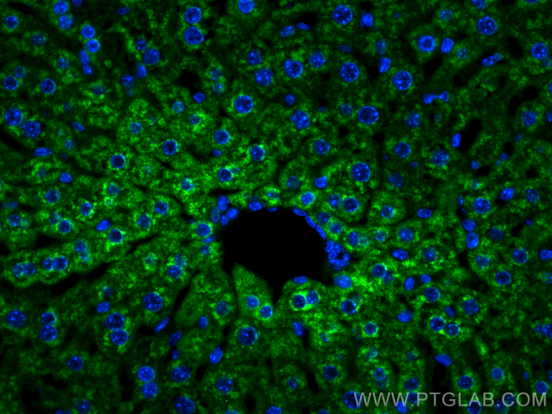 Immunofluorescent analysis of (4% PFA) fixed paraffin-embedded mouse liver tissue using G6PC antibody (22169-1-AP) at dilution of 1:200 and CoraLite®488-Conjugated Goat Anti-Rabbit IgG(H+L) (<a class='green' href='/productredirect?CatalogNo=SA00013-2' target='_blank'>SA00013-2</a>). Heat mediated antigen retrieval with Tris-EDTA buffer (pH 9.0). IF Staining of mouse liver using 22169-1-AP