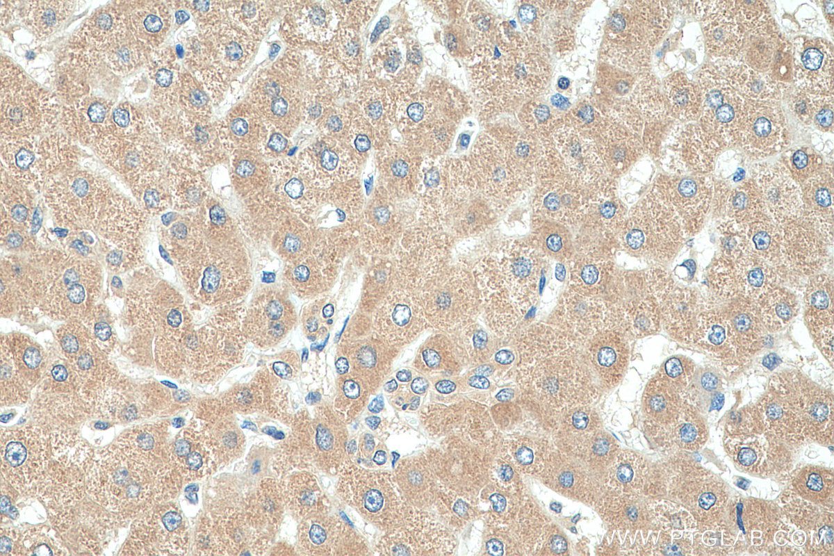 IHC staining of human liver using 22169-1-AP