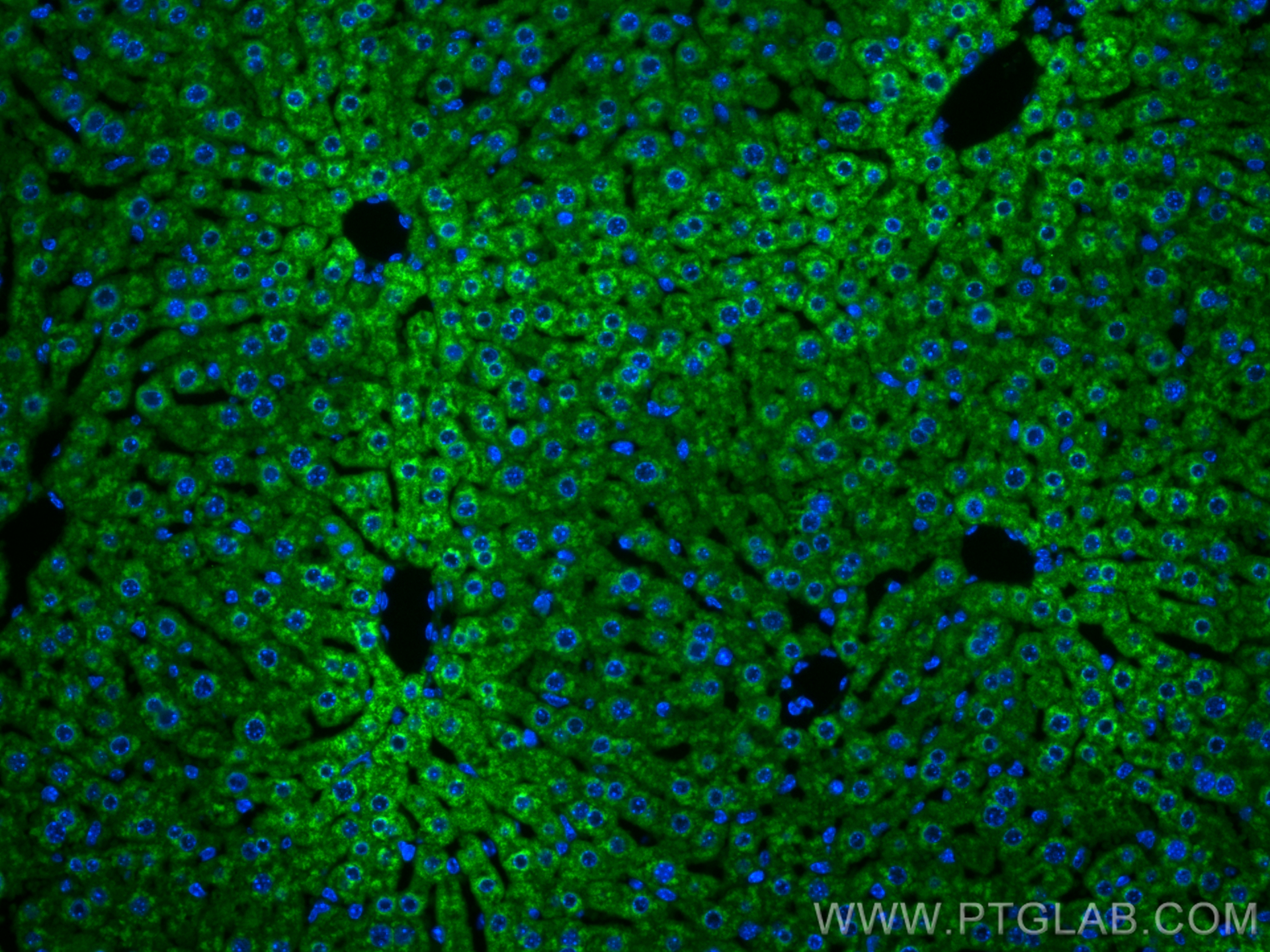 IF Staining of mouse liver using 25771-1-AP IF Staining of mouse liver using 25771-1-AP