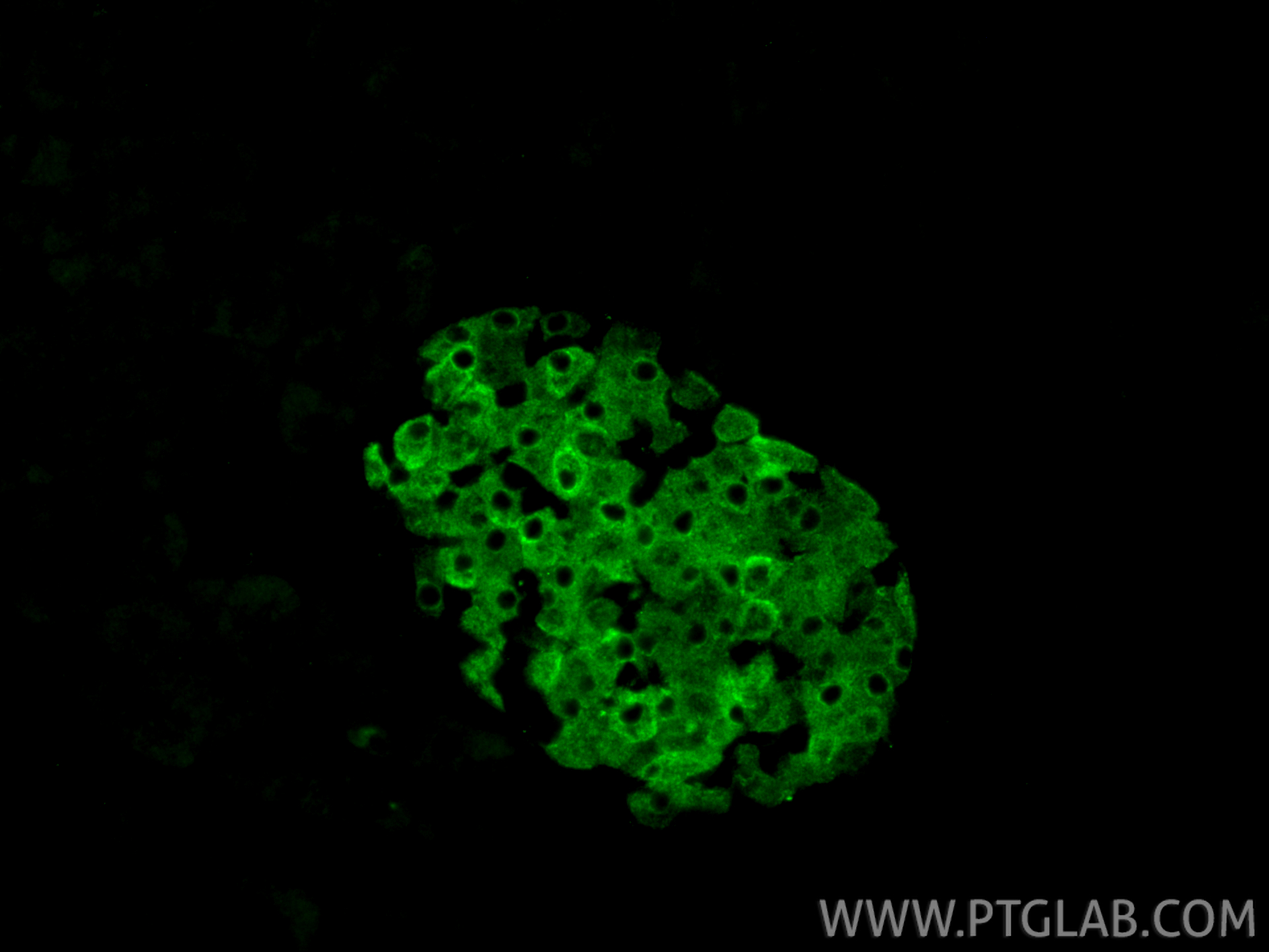 IF Staining of mouse pancreas using 18074-1-AP