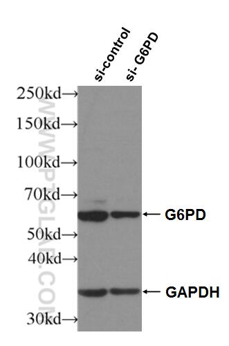 WB analysis of HeLa using 25413-1-AP