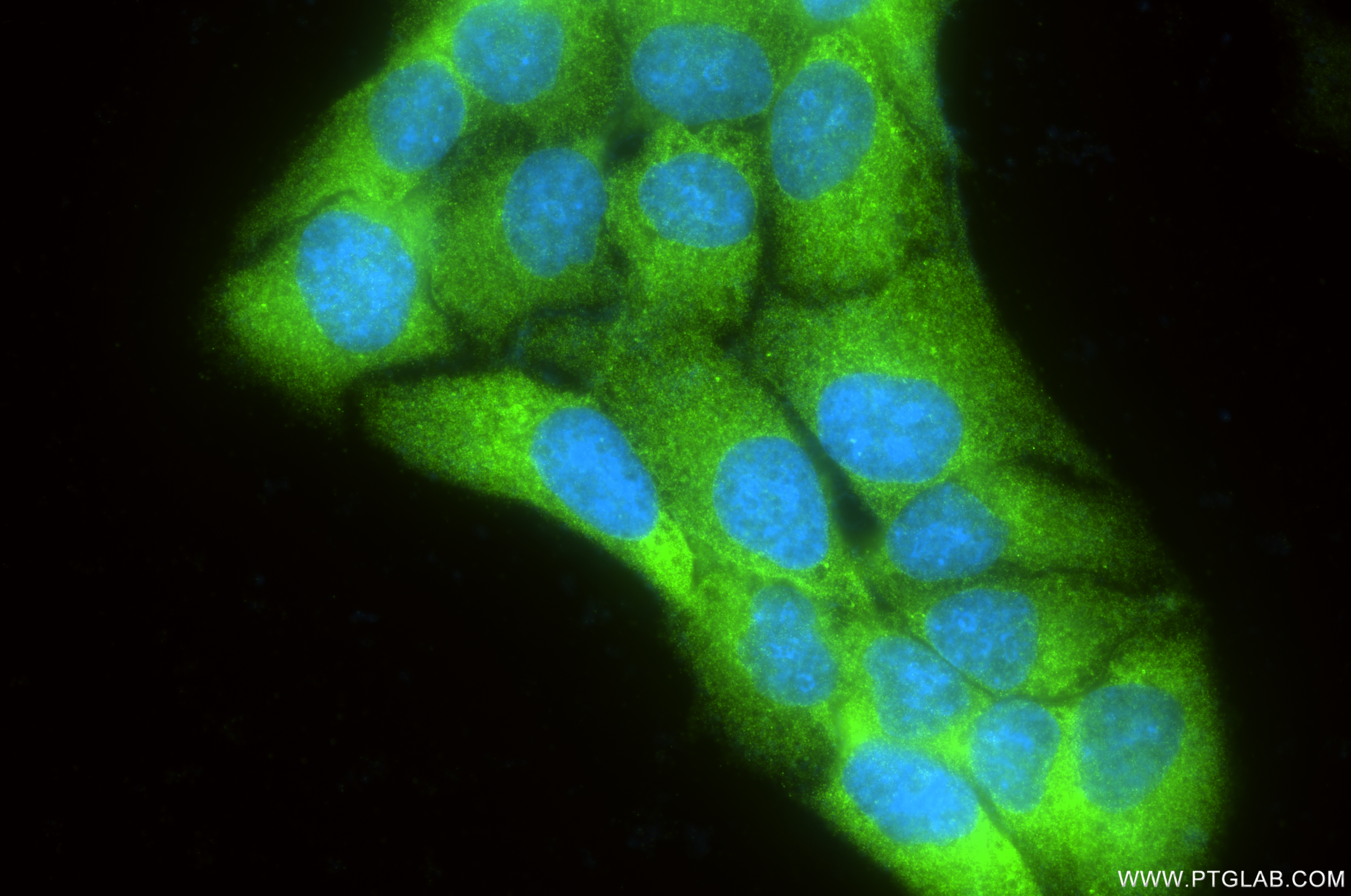 IF Staining of HeLa using 86240-1-RR