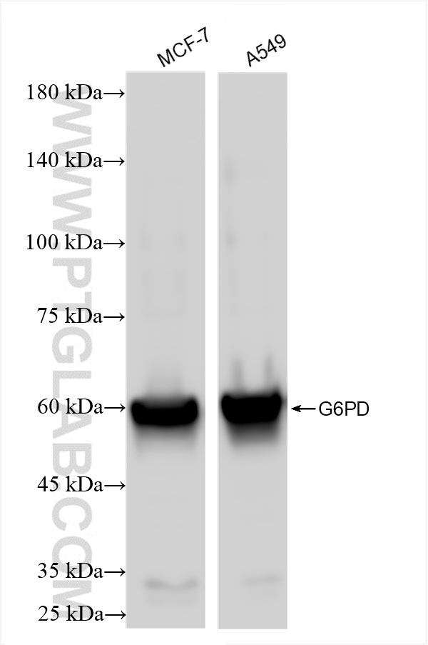WB analysis using 86240-1-RR