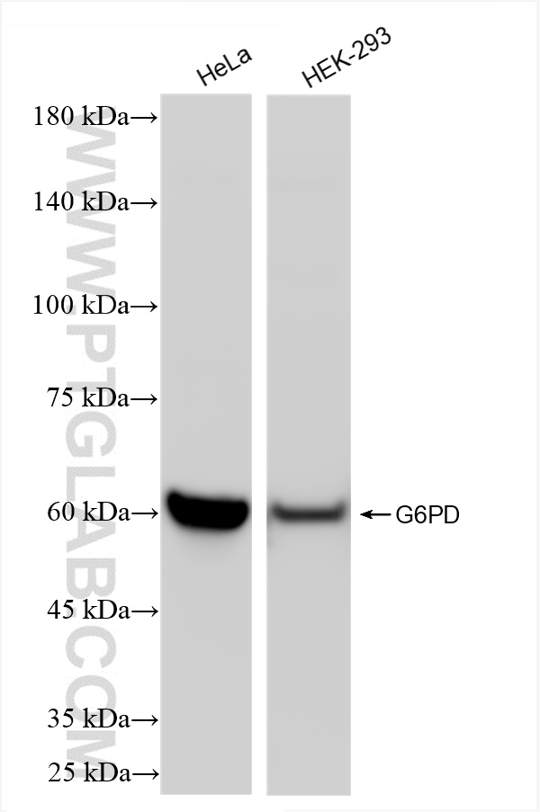 WB analysis using 86240-1-RR