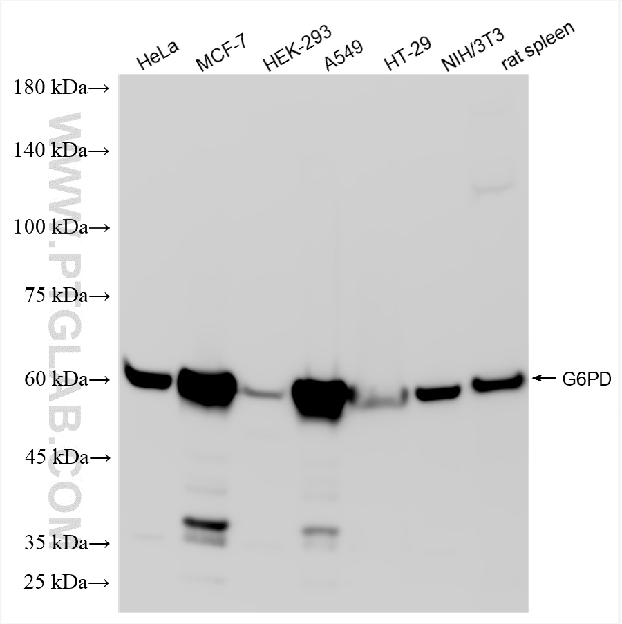 HeLa cells were subjected to SDS PAGE followed by western blot with <a class='green' href='/productredirect?CatalogNo=86240-2-RR' target='_blank'>86240-2-RR</a> (G6PD antibody) at dilution of 1:10000 incubated at room temperature for 1.5 hours. This data was developed using the same antibody clone with 86240-2-PBS in a different storage buffer formulation. WB analysis using 86240-2-RR (same clone as 86240-2-PBS)