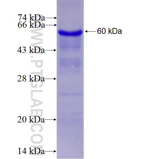G6PD fusion protein Ag21862 SDS-PAGE